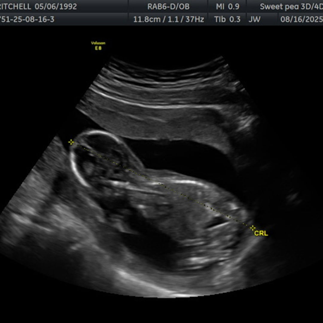Photo shared by Chel for their Babylist baby registry.