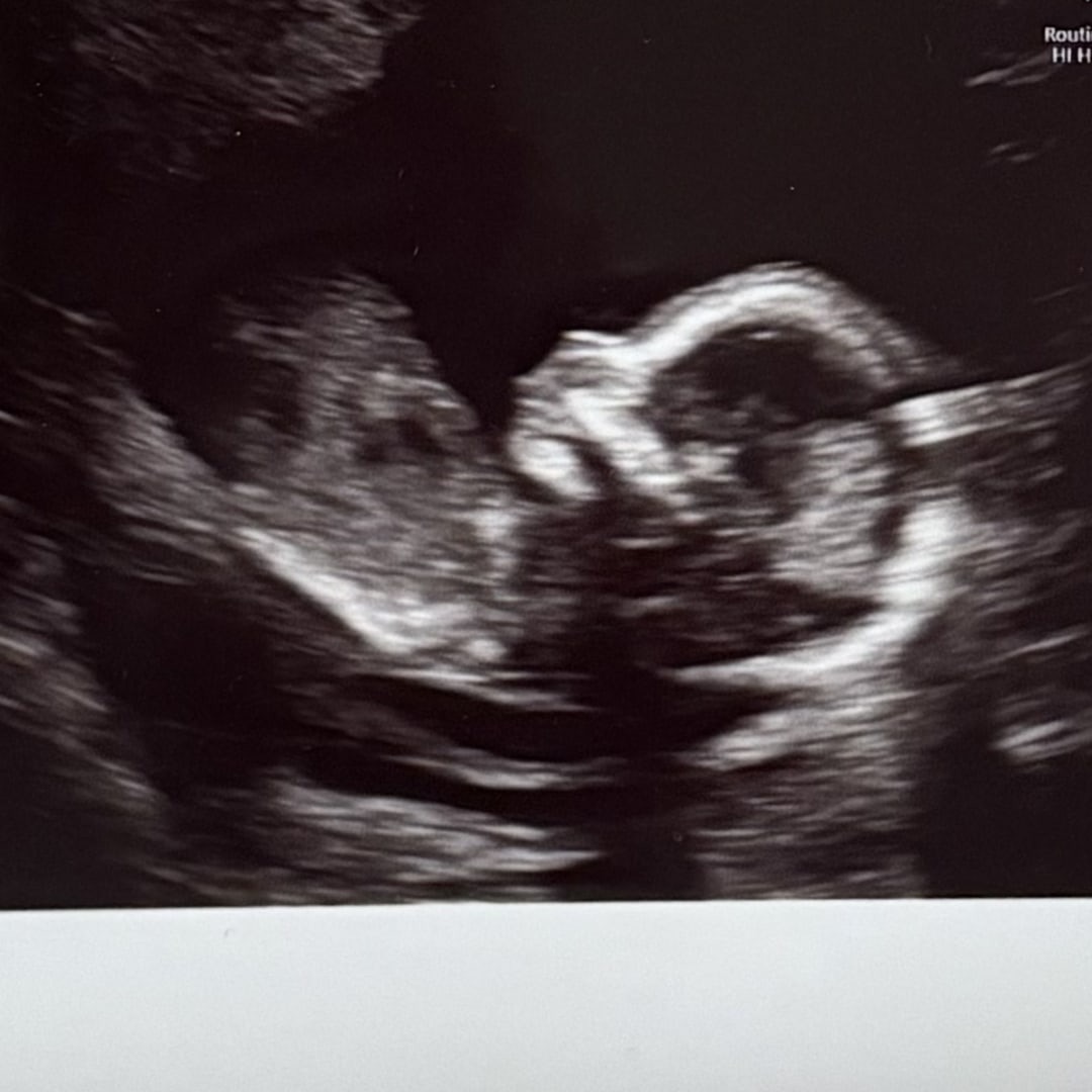 Photo shared by Alexis for their Babylist baby registry.