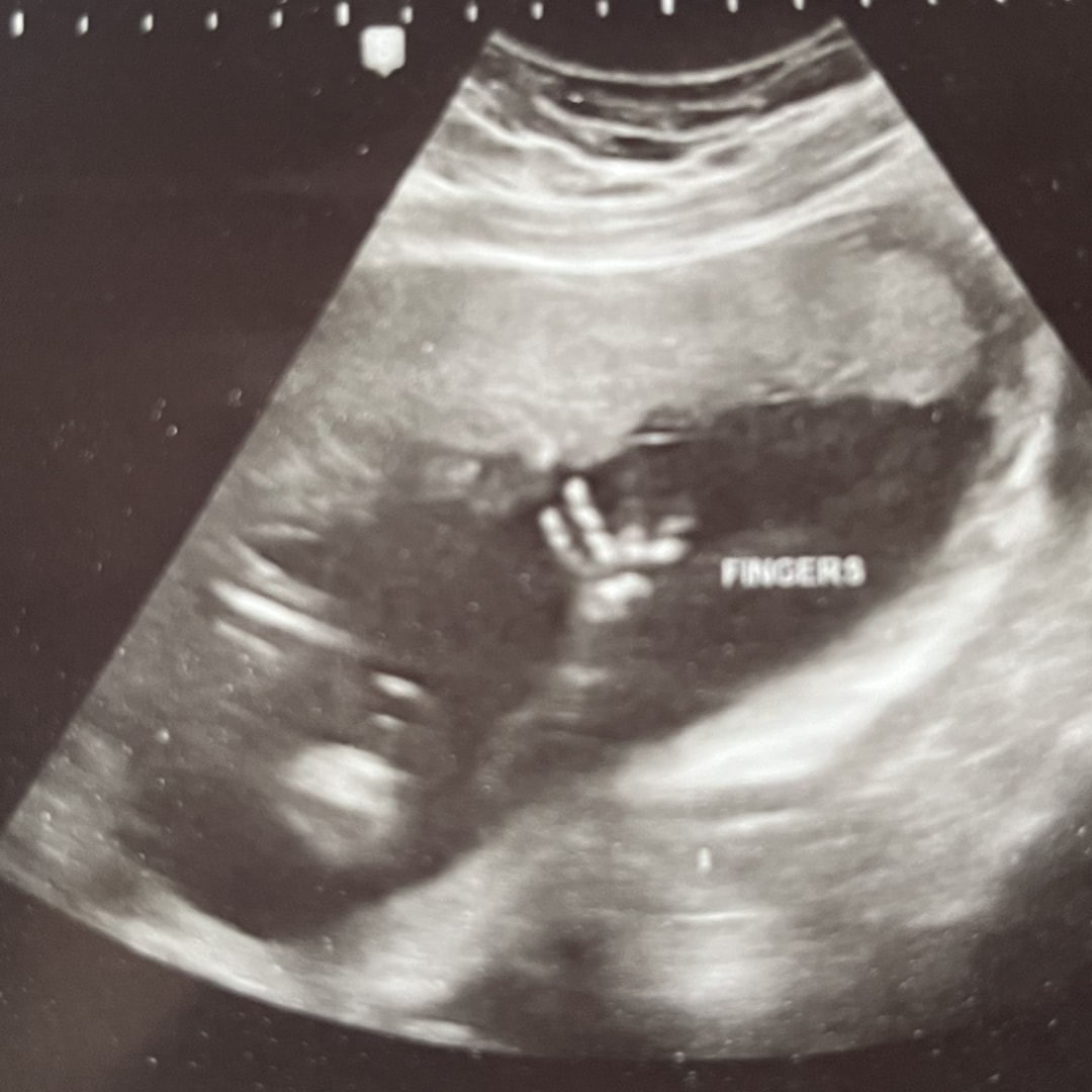 Photo shared by Akira for their Babylist baby registry.
