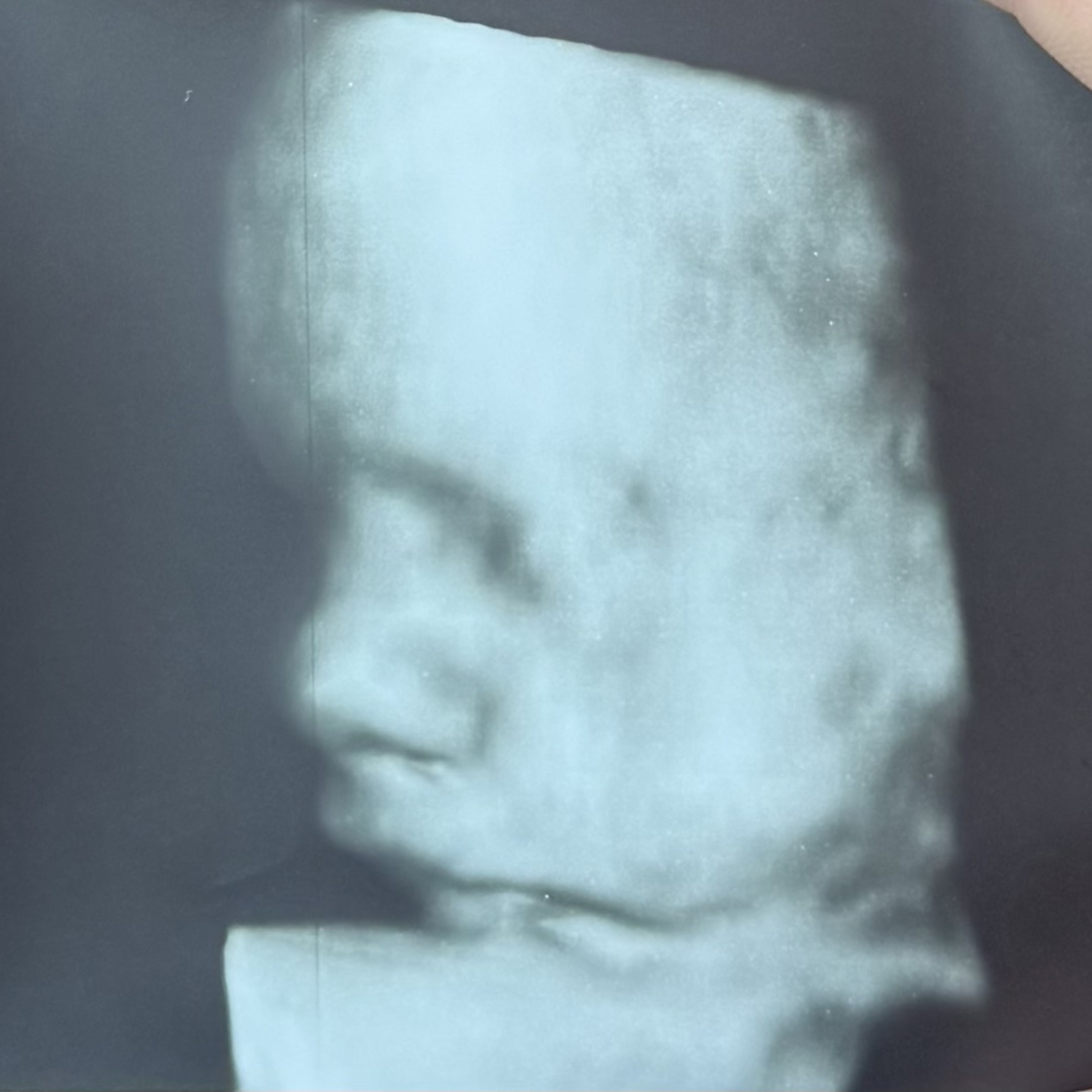 Photo shared by Gloria for their Babylist baby registry.
