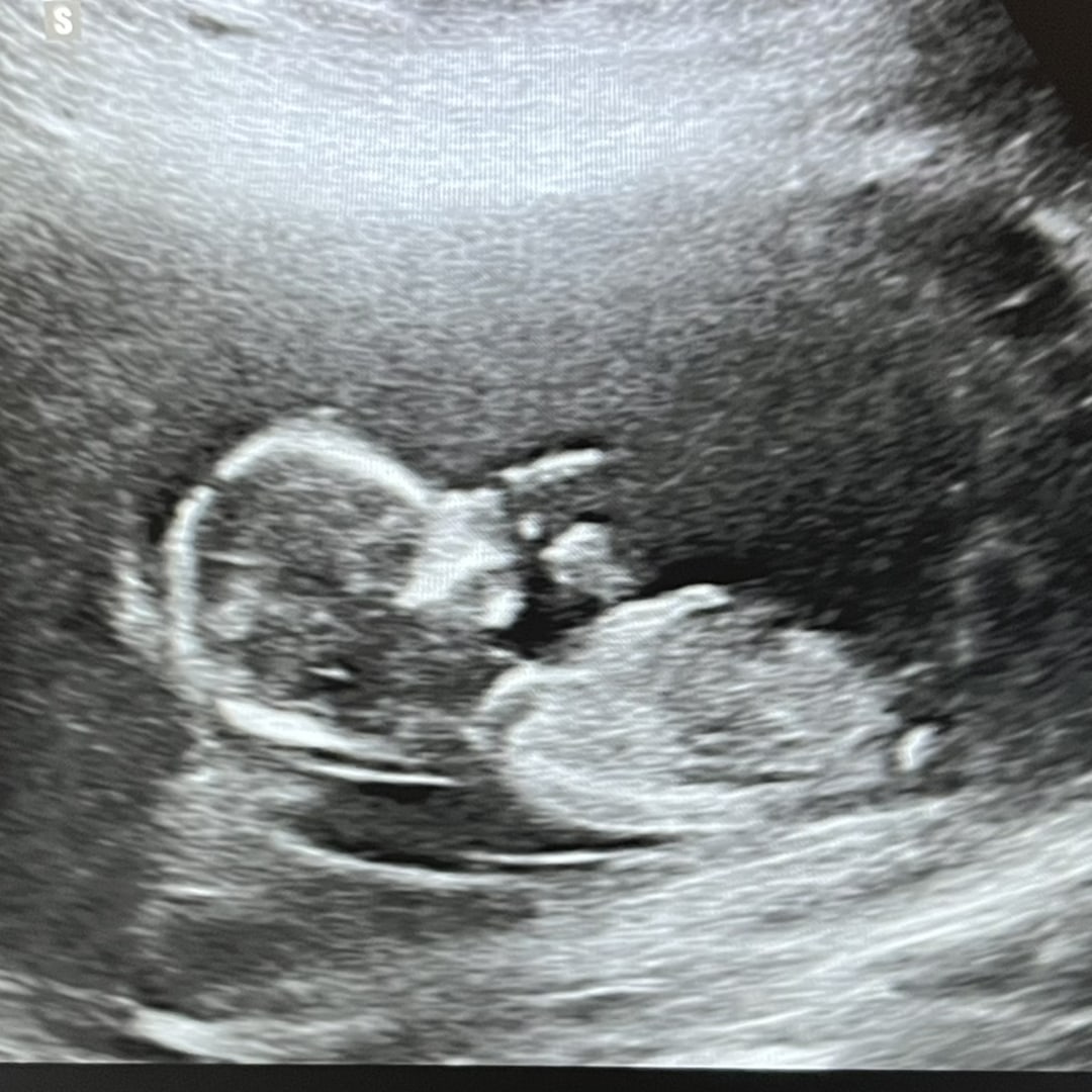 Photo shared by Victoria for their Babylist baby registry.