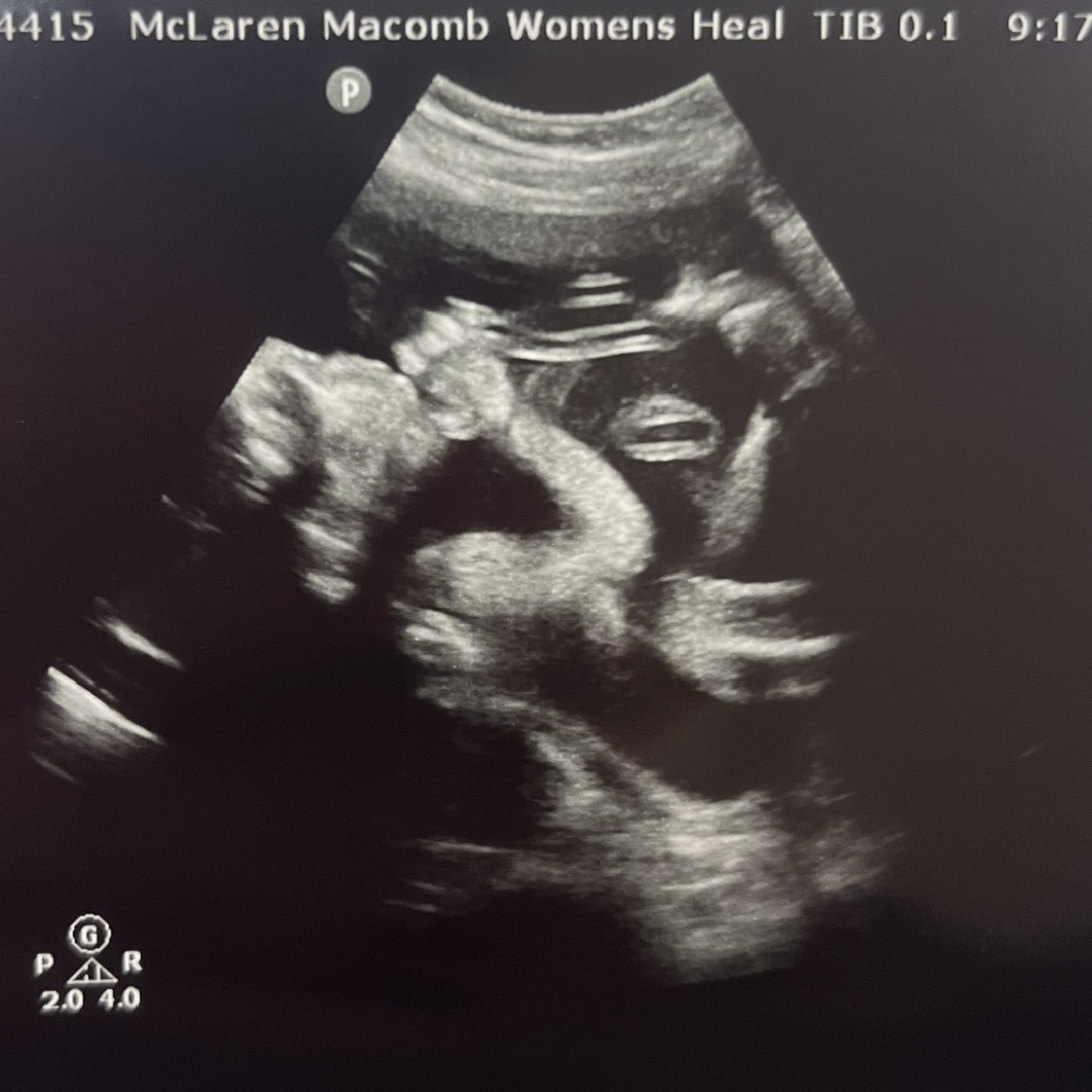 Photo shared by Olivia for their Babylist baby registry.