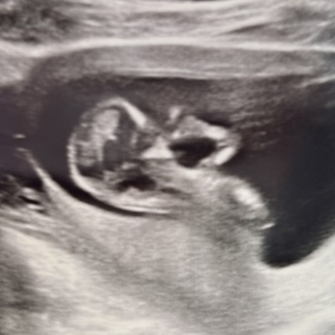 Photo shared by Alyssa for their Babylist baby registry.
