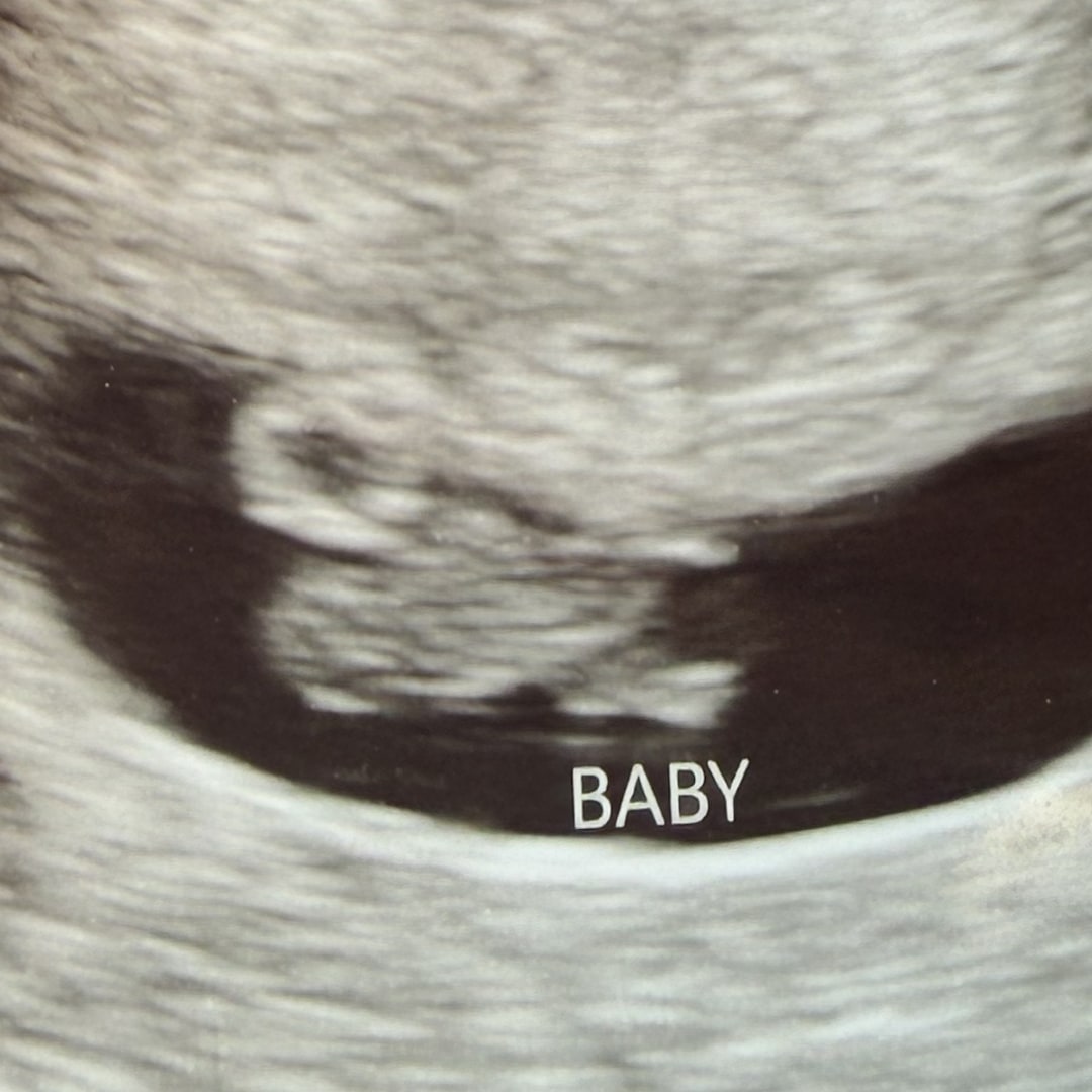 Photo shared by Breanne for their Babylist baby registry.