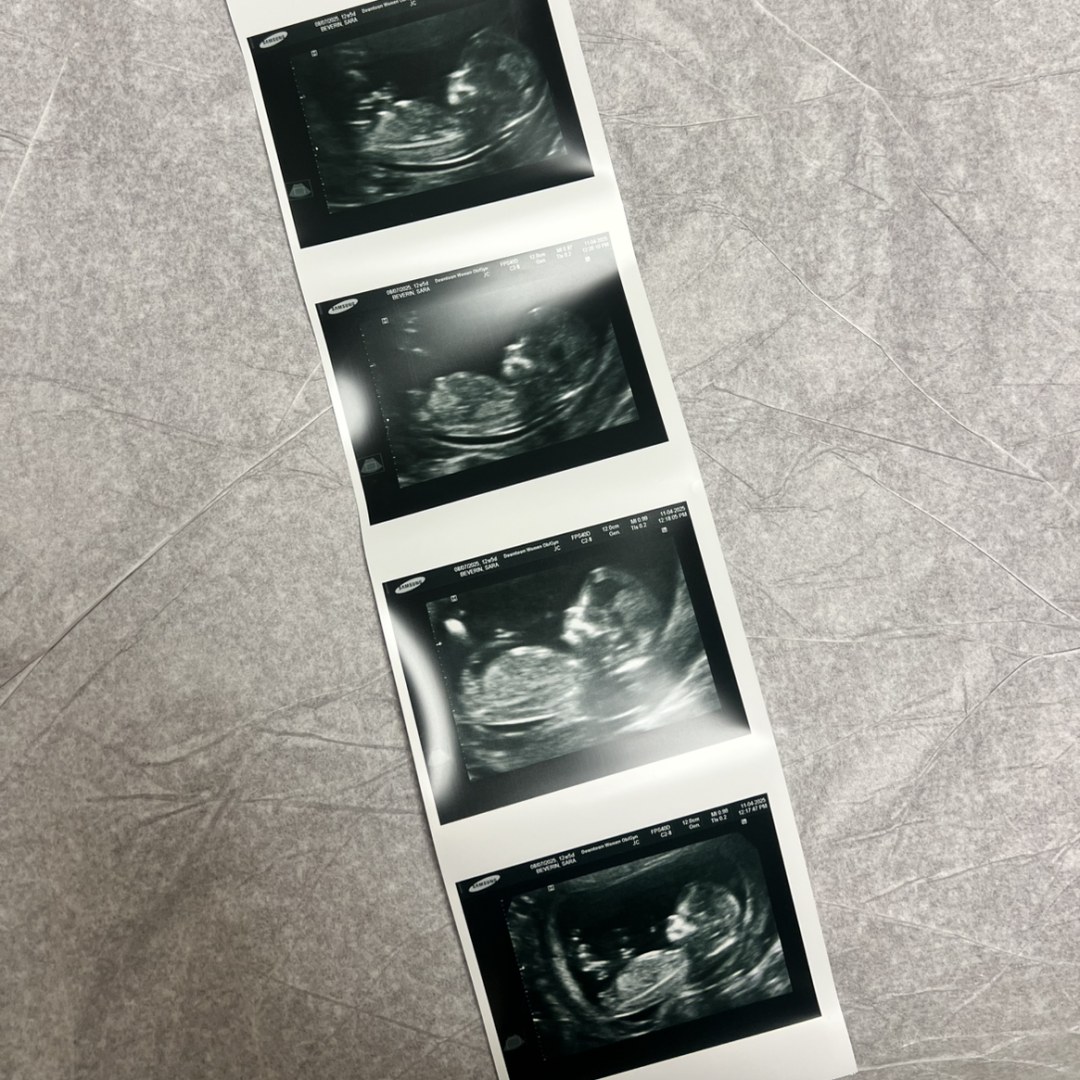 Photo shared by Sara for their Babylist baby registry.