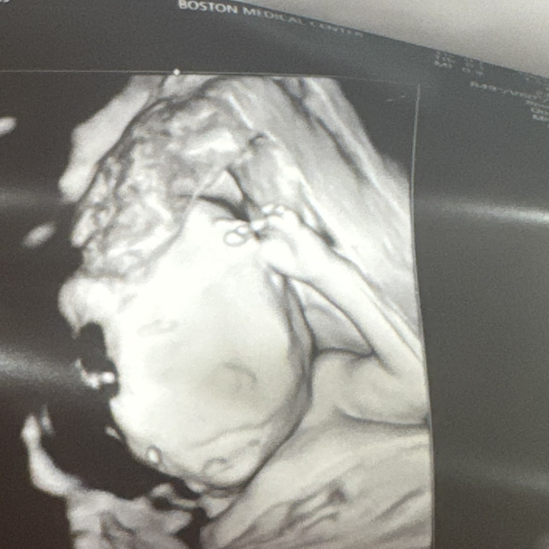 Photo shared by Kenny for their Babylist baby registry.