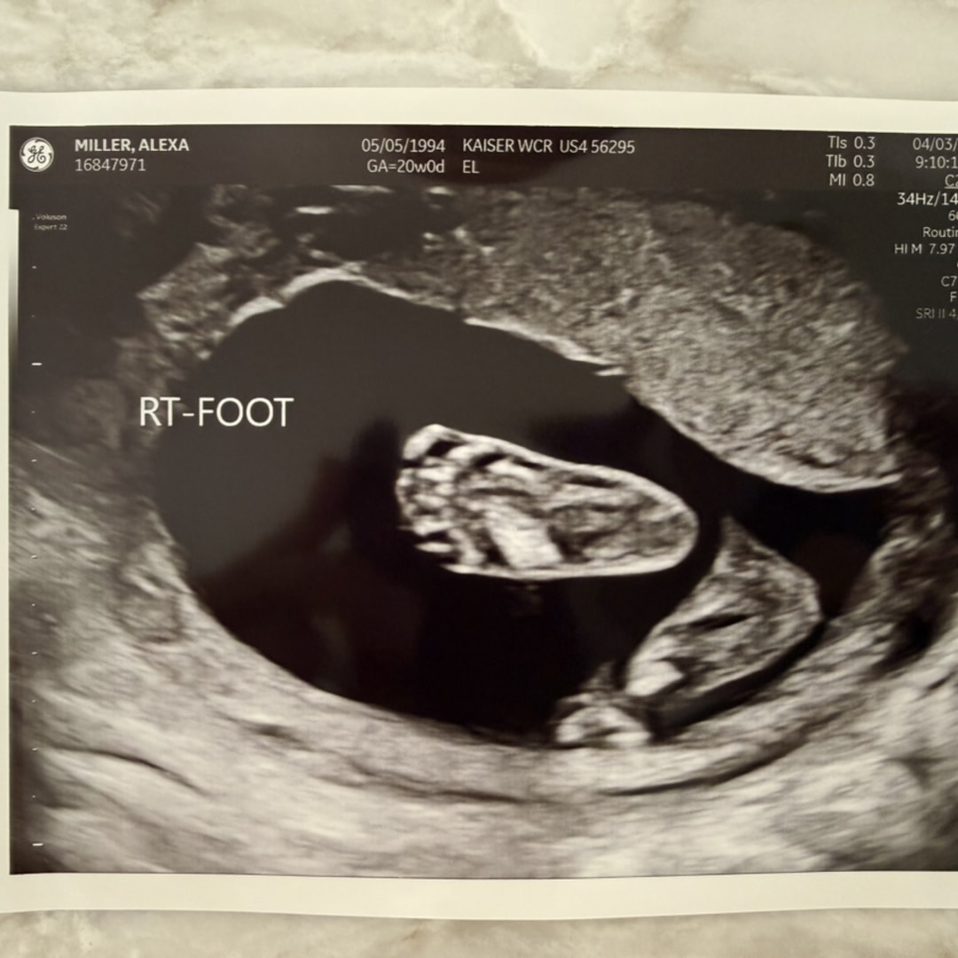 Photo shared by Lexi & Dan for their Babylist baby registry.
