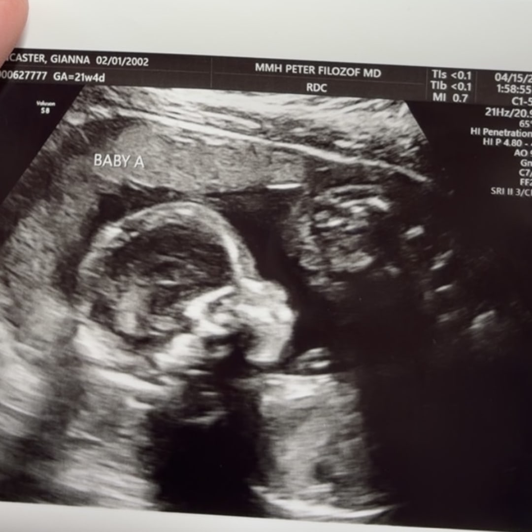 Photo shared by Gianna for their Babylist baby registry.