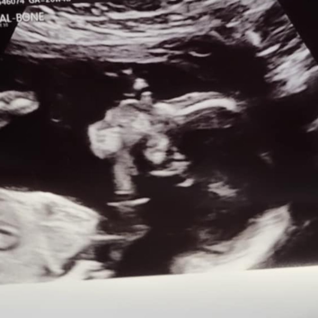 Photo shared by Trinity for their Babylist baby registry.