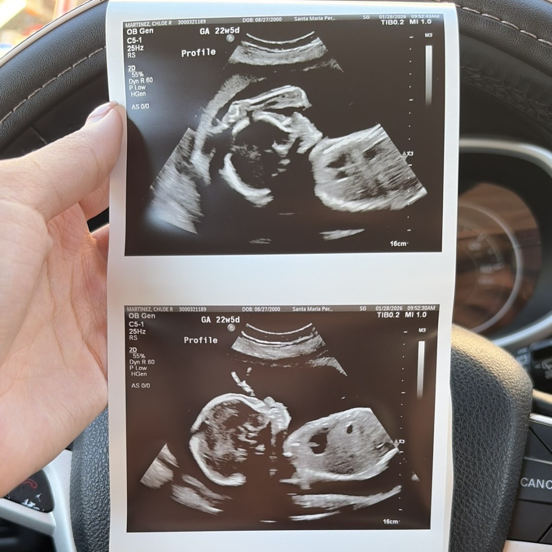 Photo shared by Chloe for their Babylist baby registry.