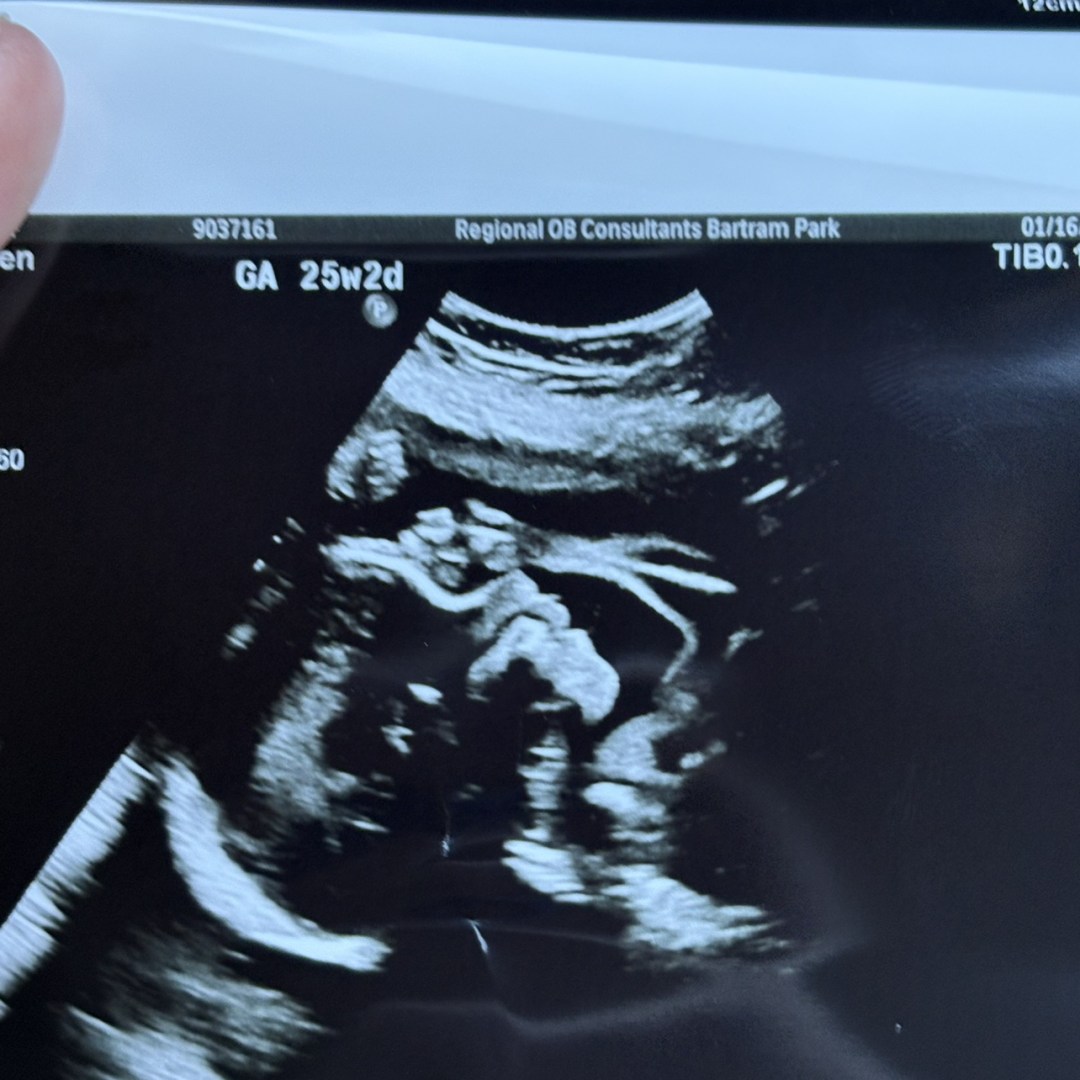 Photo shared by Kalei for their Babylist baby registry.