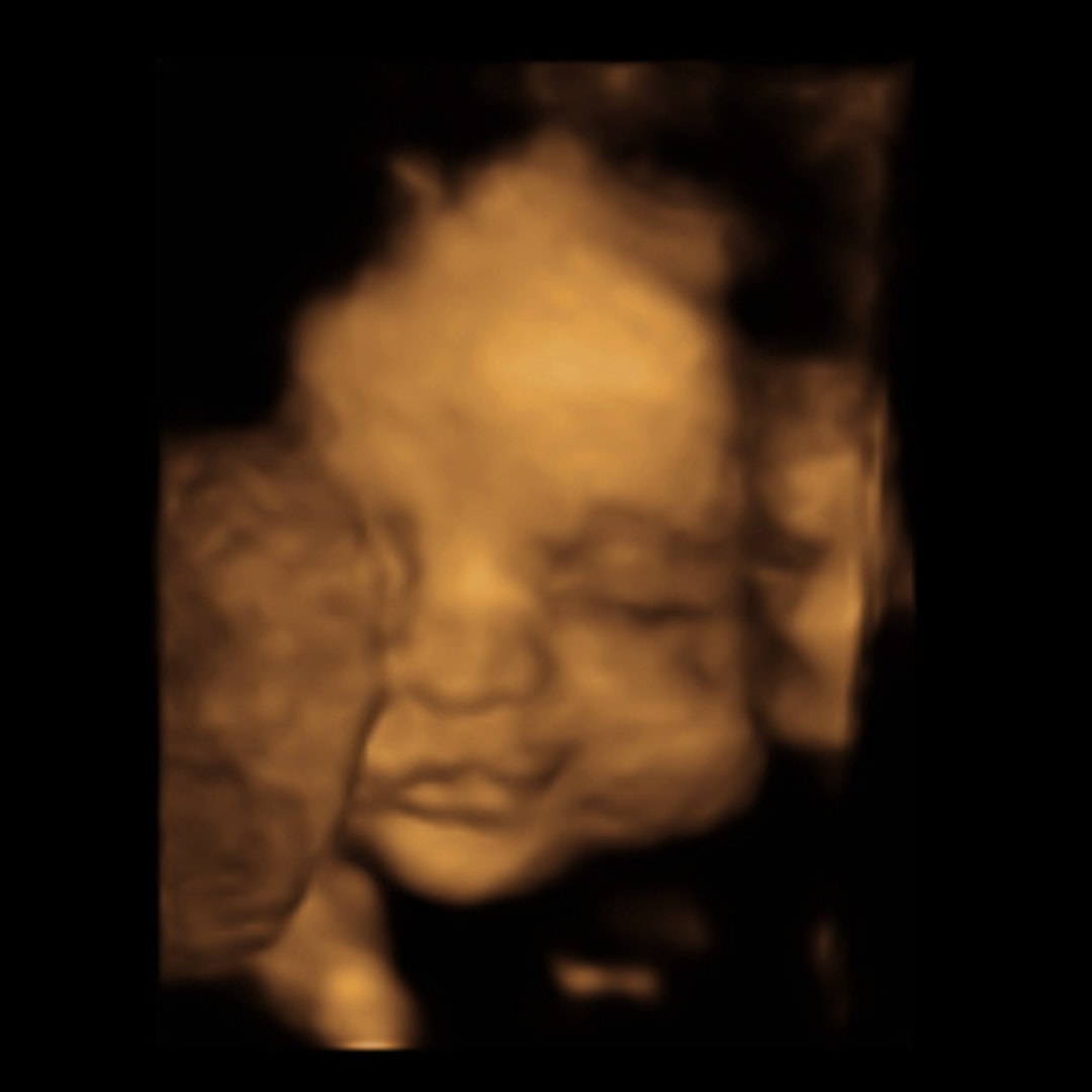 Photo shared by Alexis for their Babylist baby registry.
