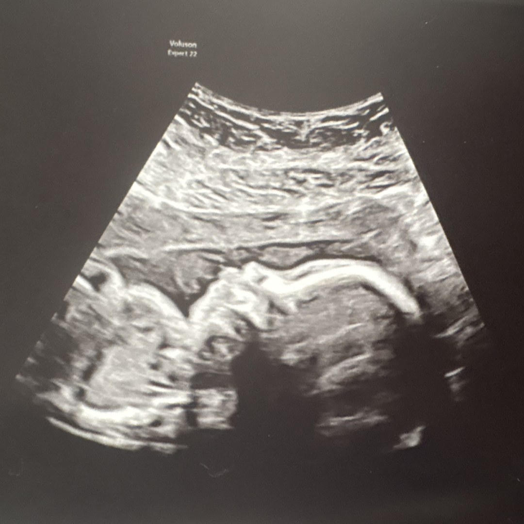 Photo shared by Alie for their Babylist baby registry.