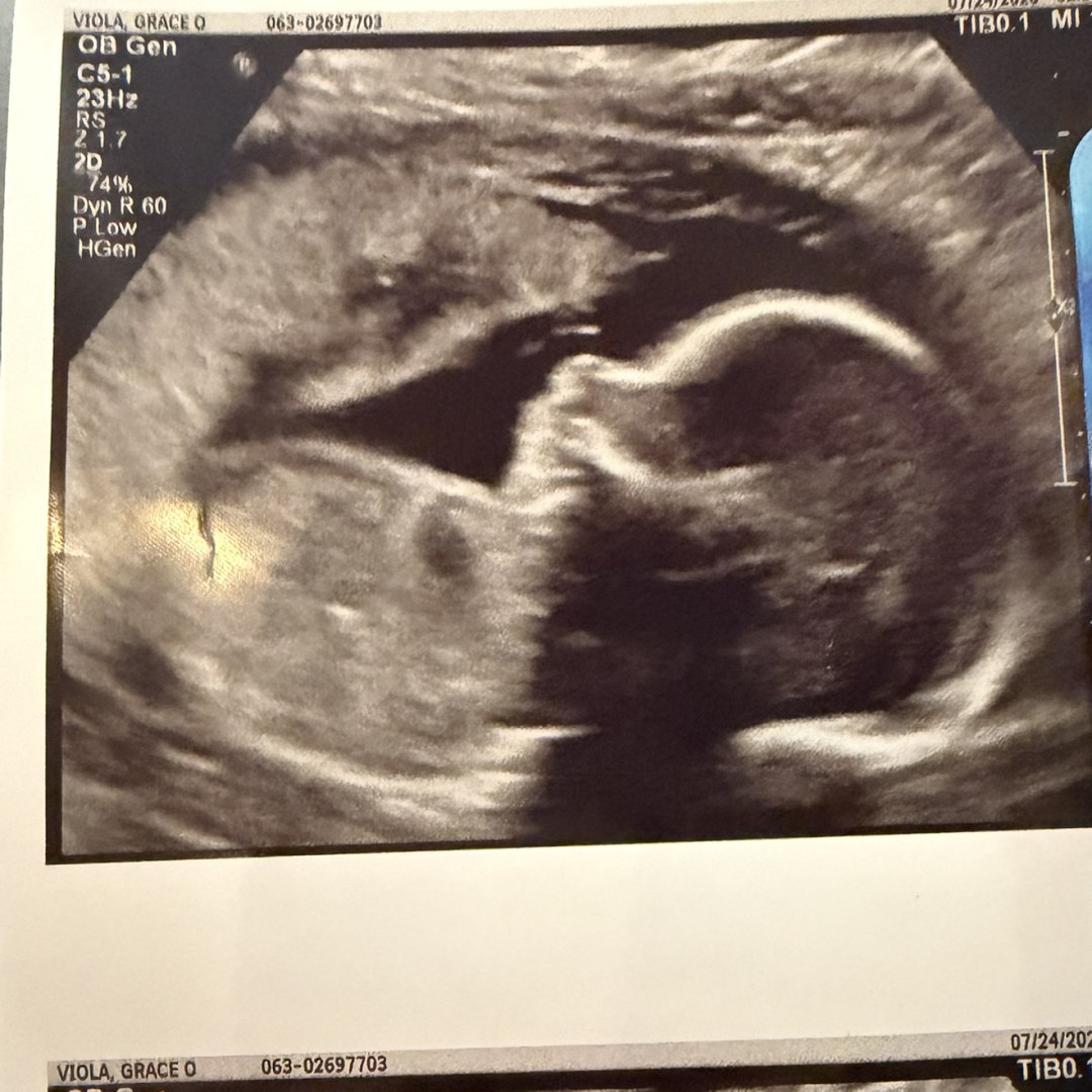 Photo shared by Grace for their Babylist baby registry.