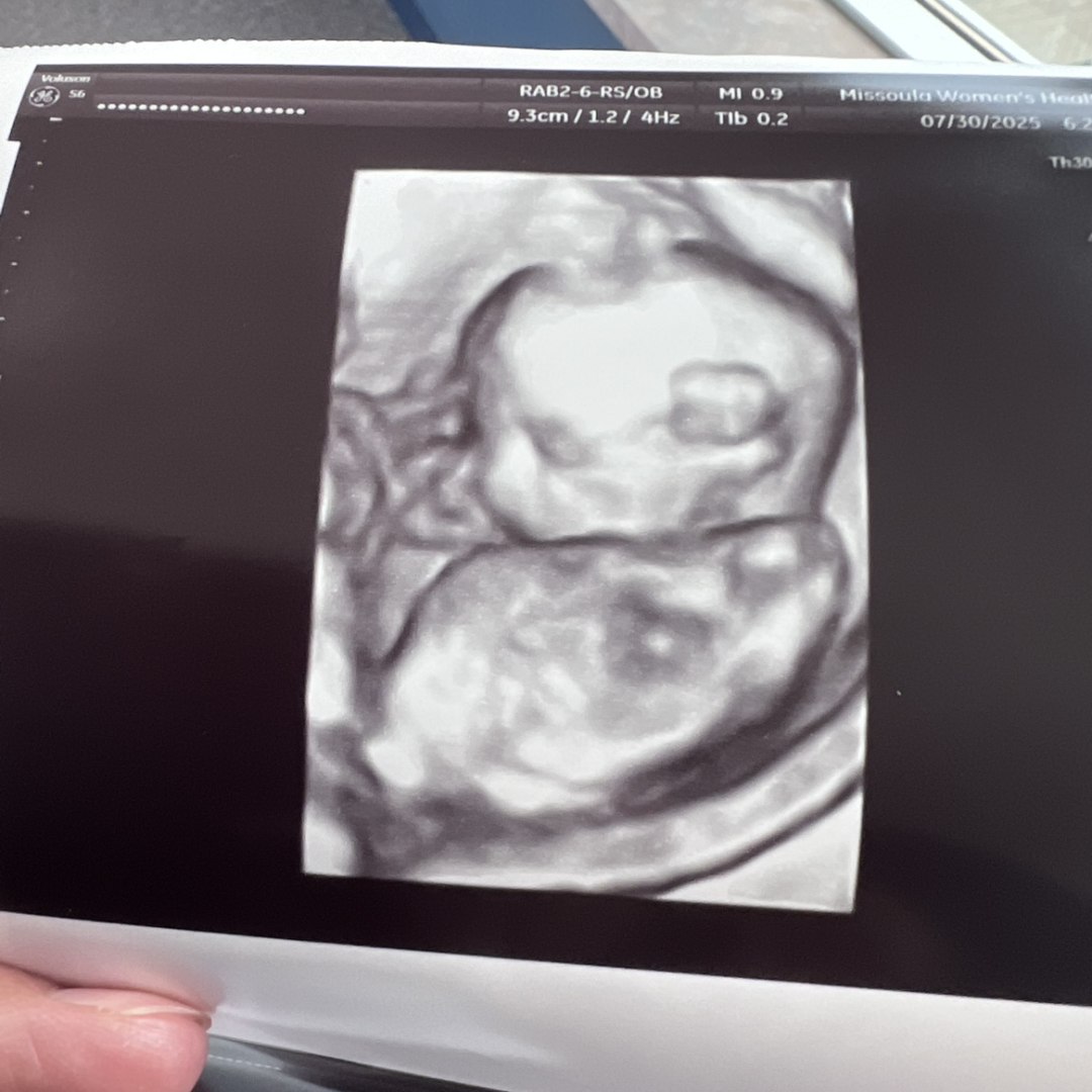 Photo shared by Megan for their Babylist baby registry.