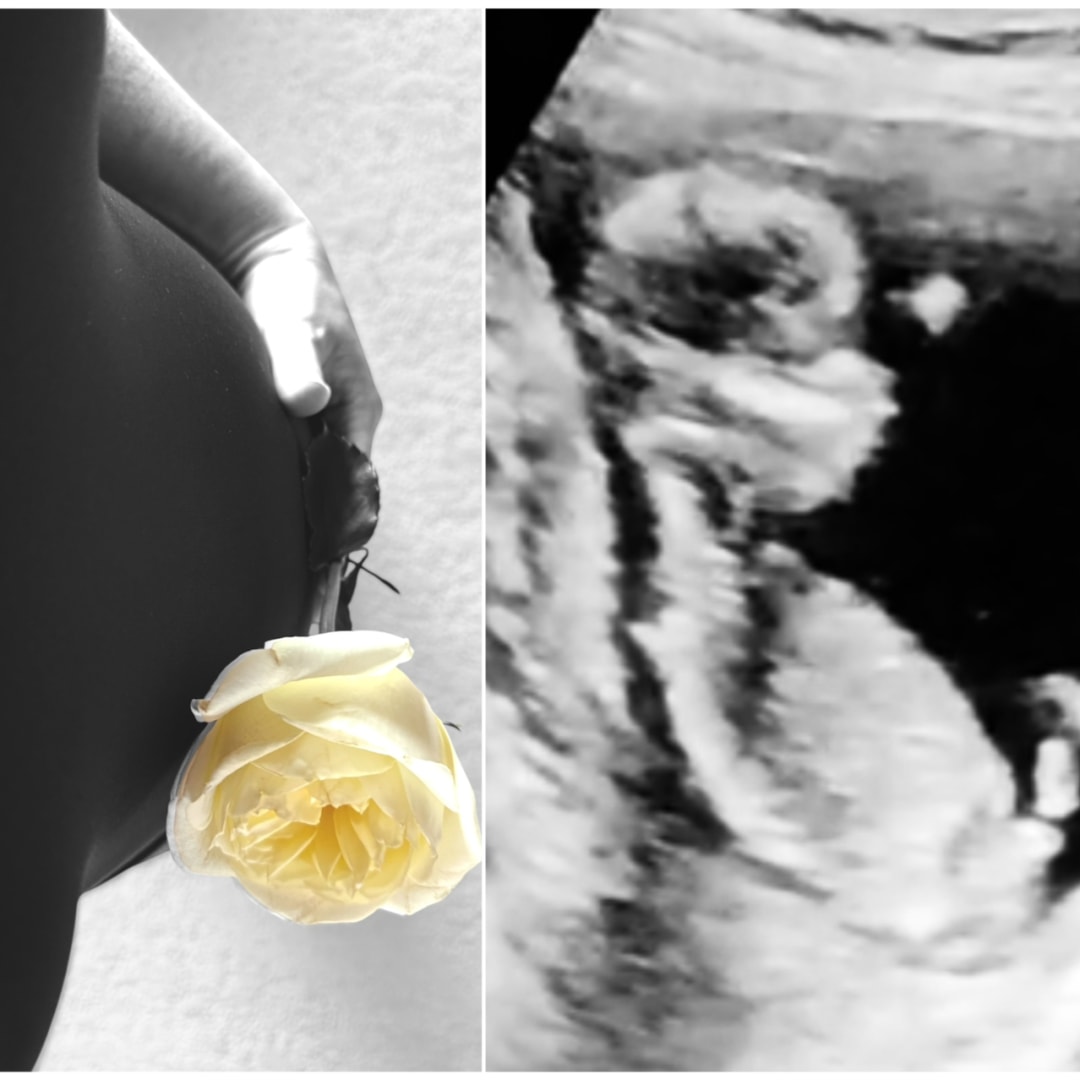 Photo shared by Jessie for their Babylist baby registry.