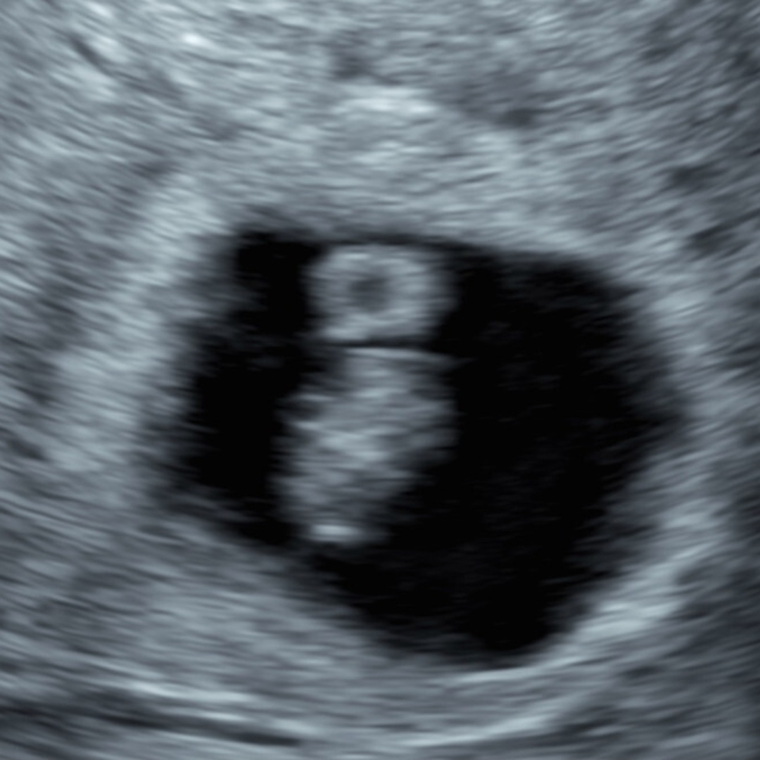Photo shared by Teresa for their Babylist baby registry.