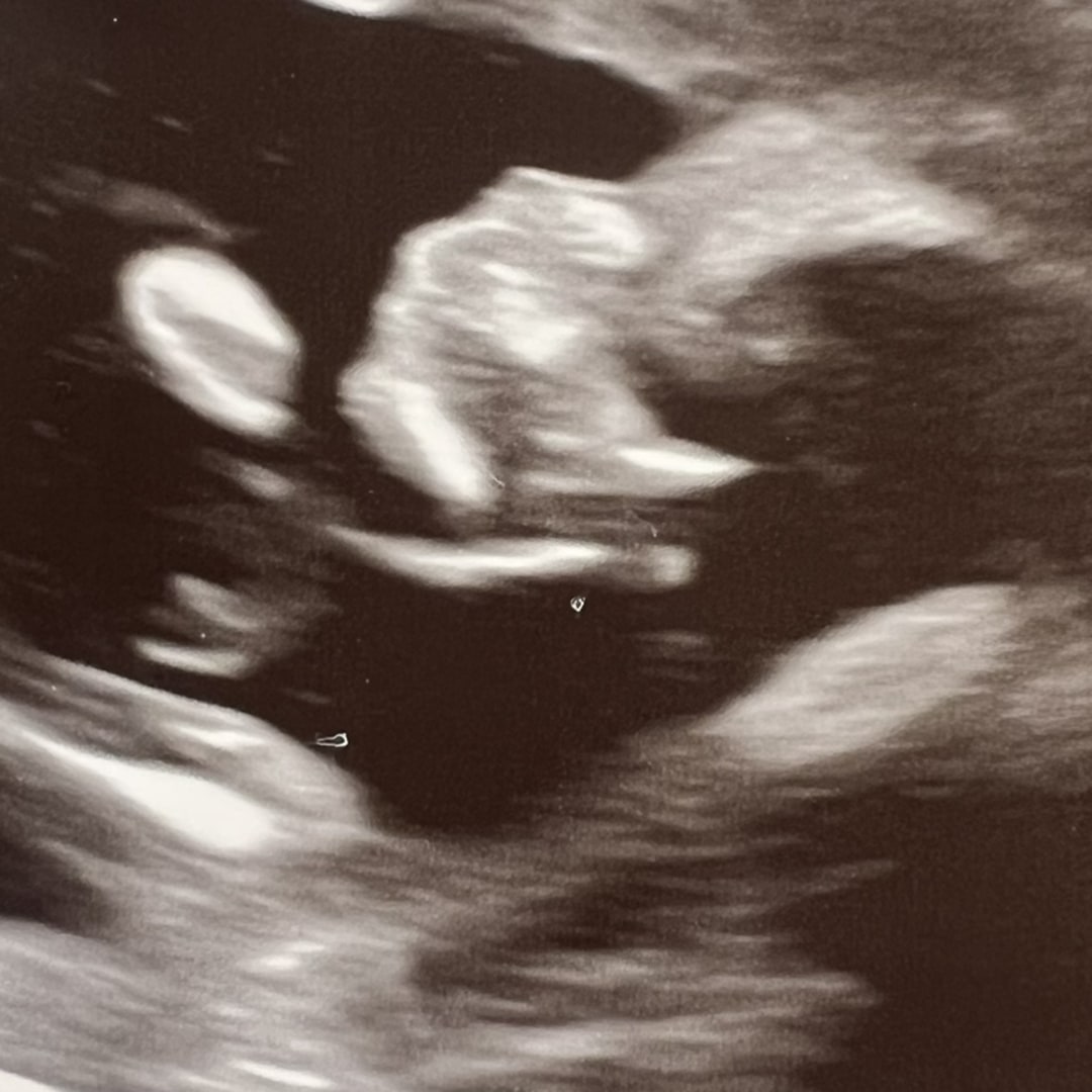 Photo shared by Julia for their Babylist baby registry.