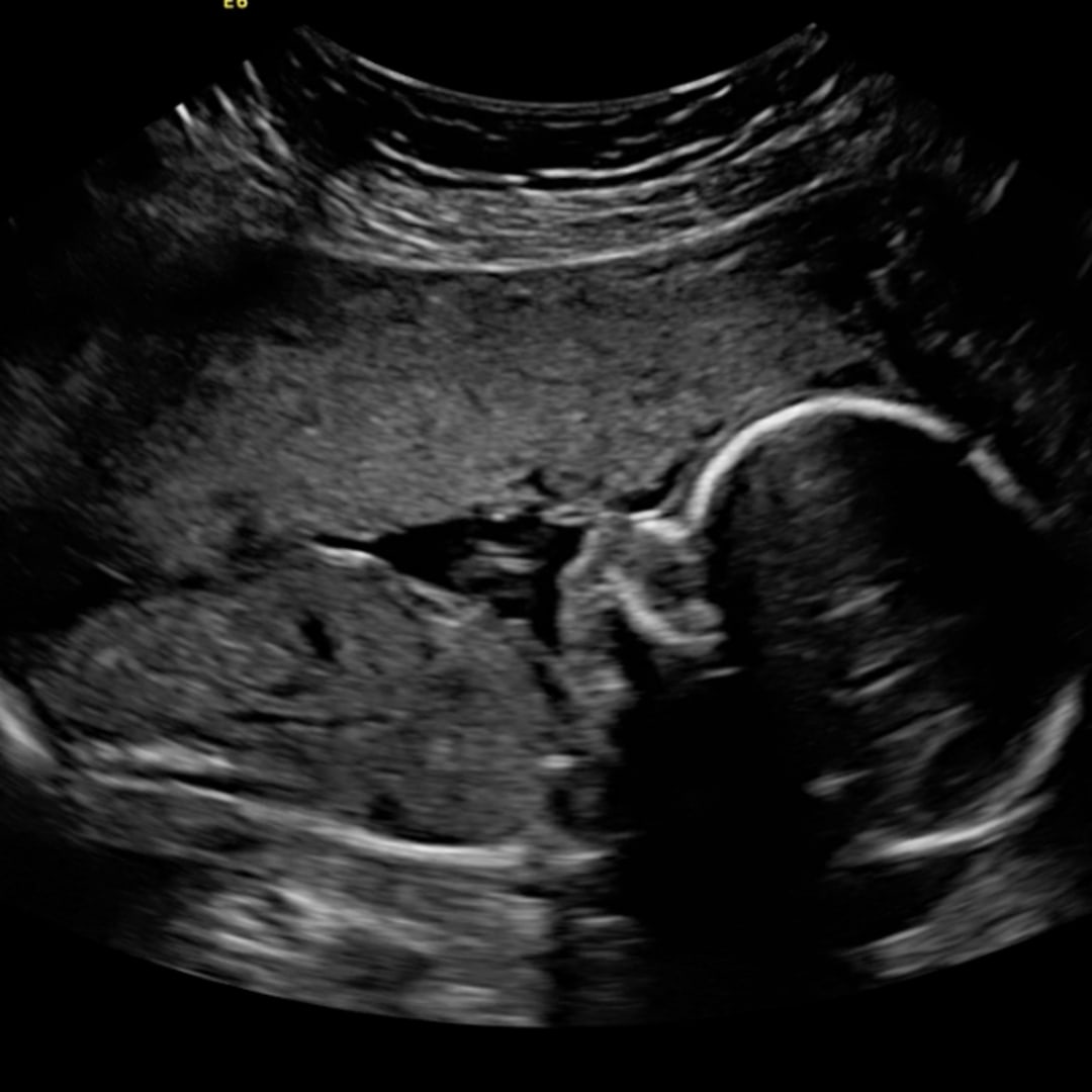 Photo shared by Abby for their Babylist baby registry.