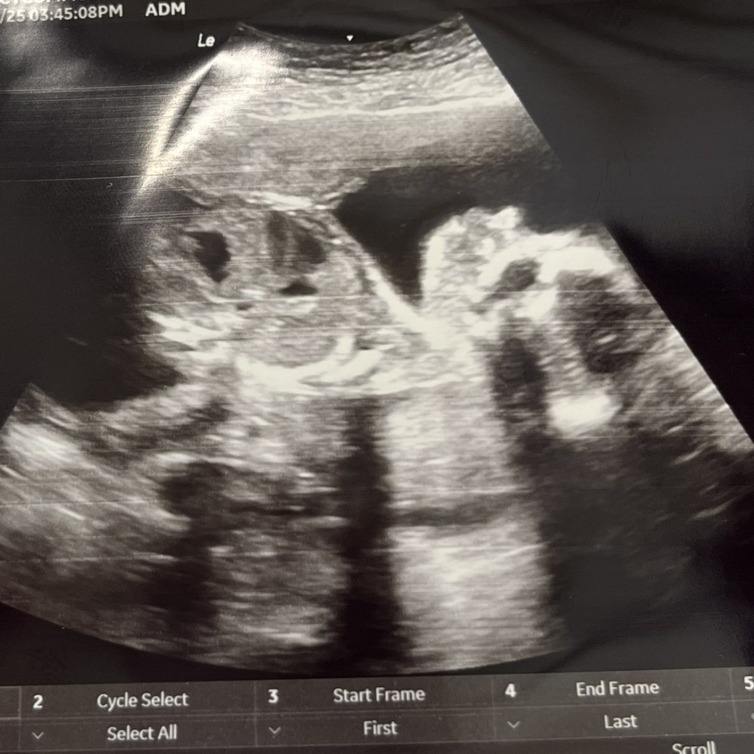 Photo shared by Shacty for their Babylist baby registry.