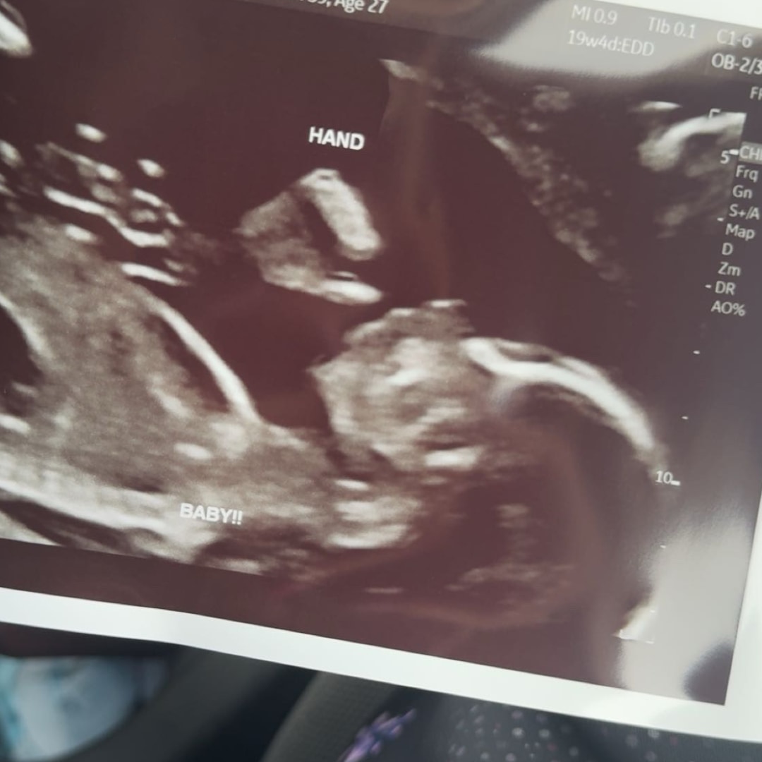 Photo shared by Nicole for their Babylist baby registry.