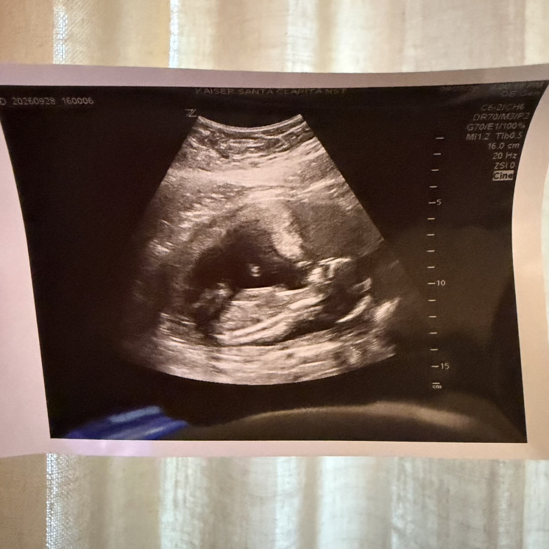 Photo shared by Briana for their Babylist baby registry.