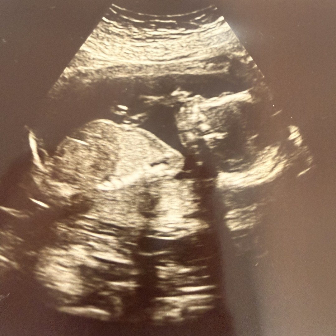Photo shared by Jannet for their Babylist baby registry.