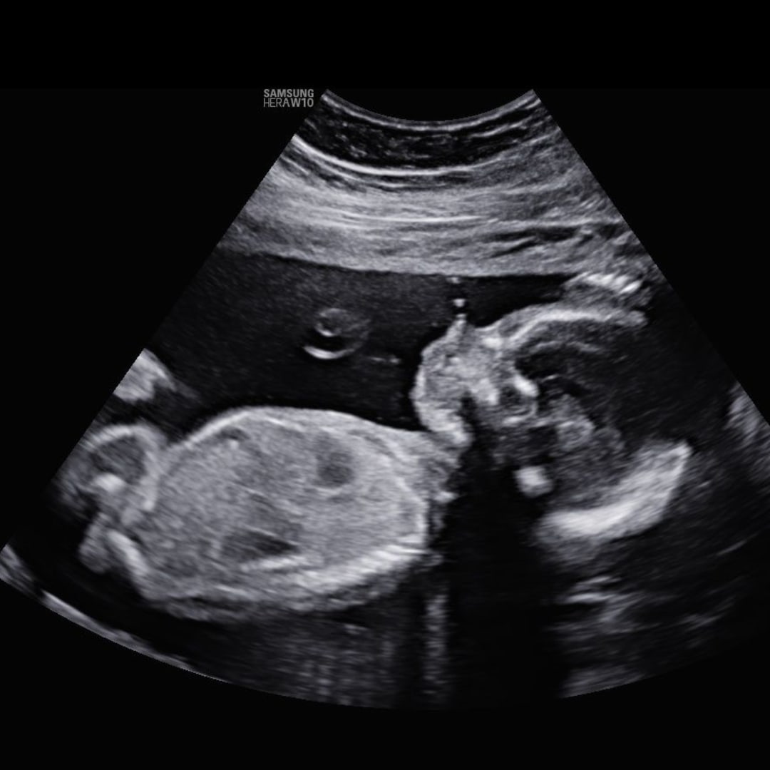 Photo shared by Monique for their Babylist baby registry.