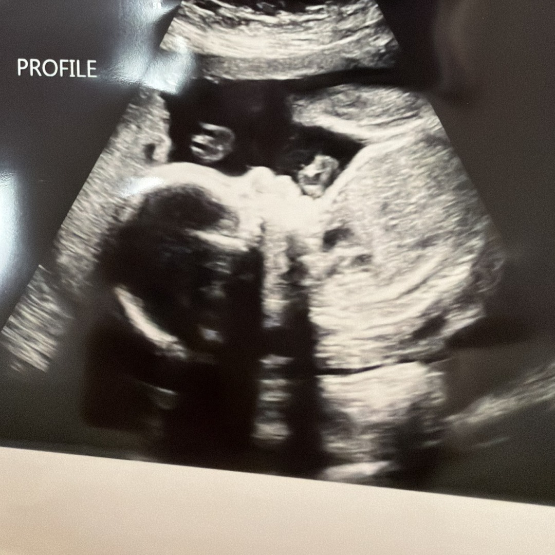 Photo shared by Ellie for their Babylist baby registry.
