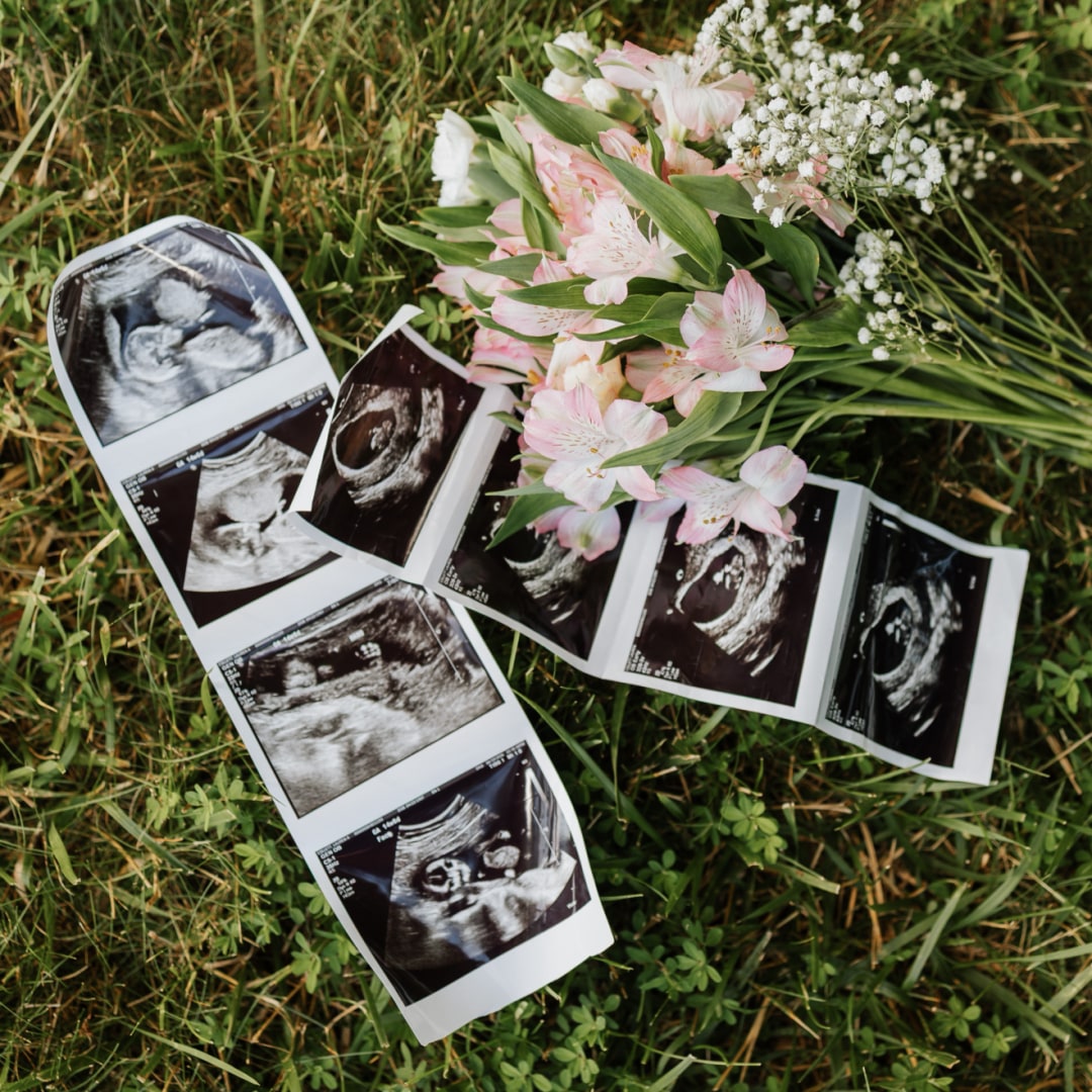 Photo shared by Lauren for their Babylist baby registry.