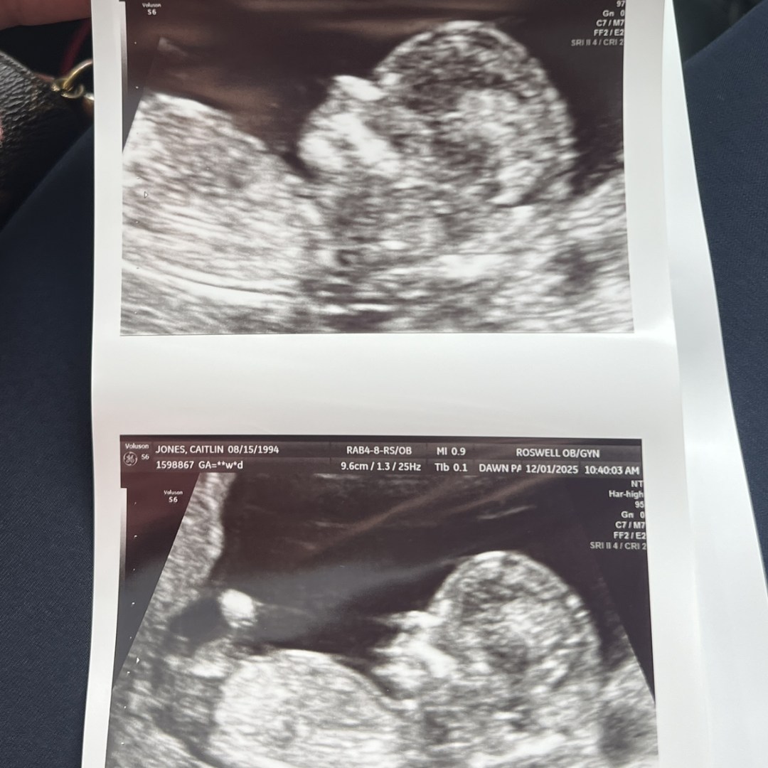 Photo shared by Caitlin for their Babylist baby registry.