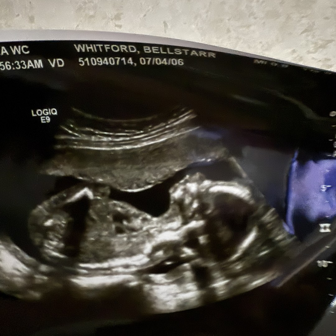 Photo shared by Bellstarr for their Babylist baby registry.