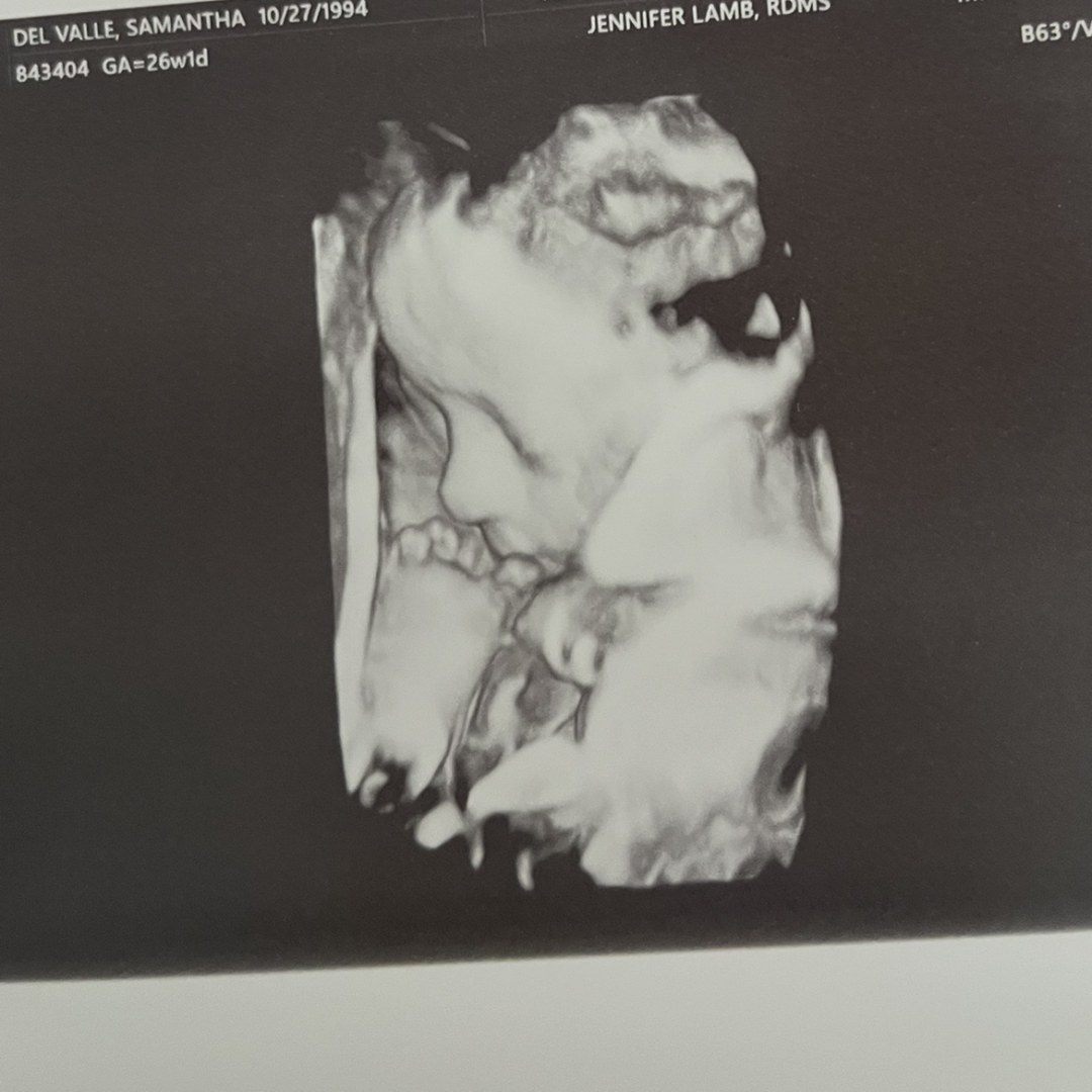 Photo shared by Samantha for their Babylist baby registry.