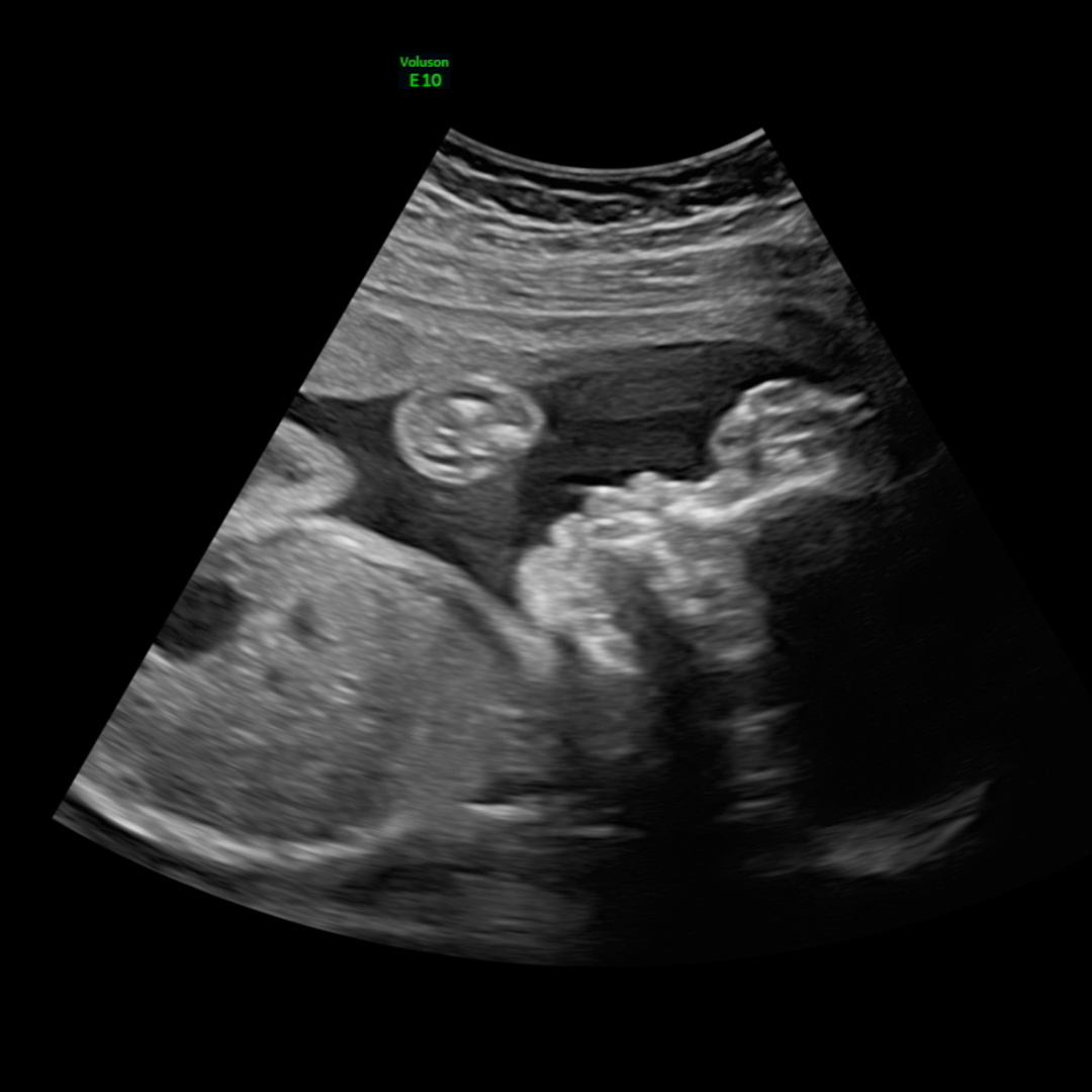 Photo shared by Ashley-Rachel for their Babylist baby registry.