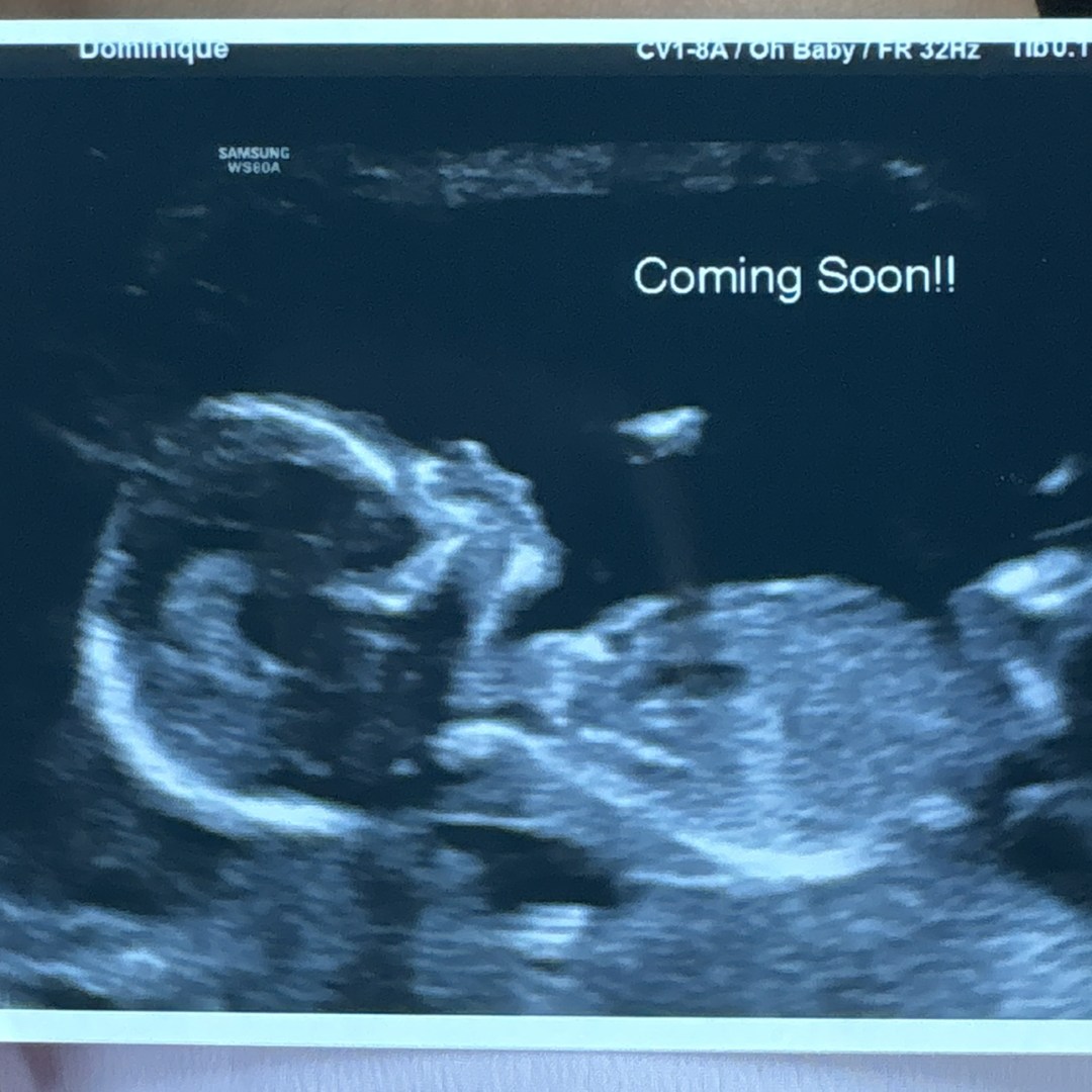 Photo shared by Dominique for their Babylist baby registry.