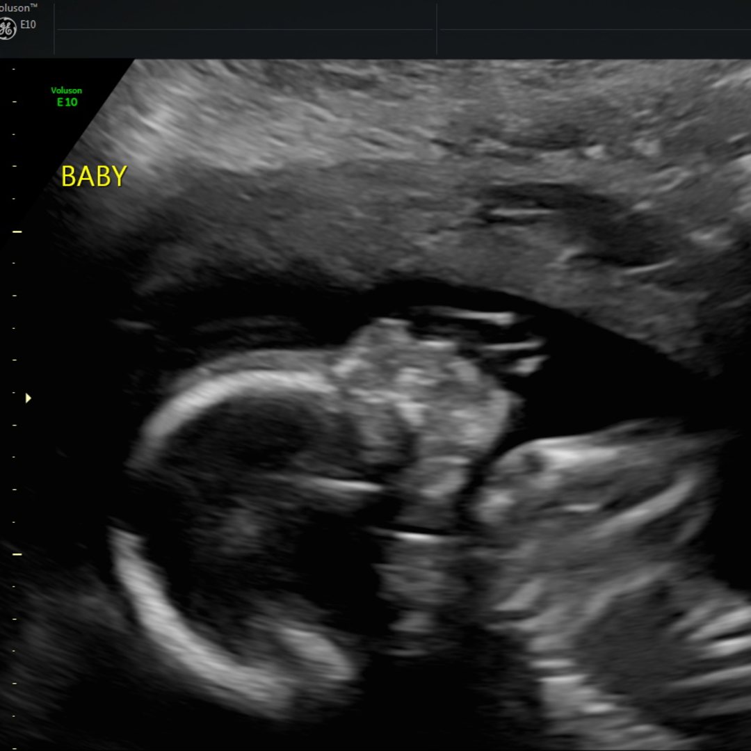 Photo shared by Brittany for their Babylist baby registry.