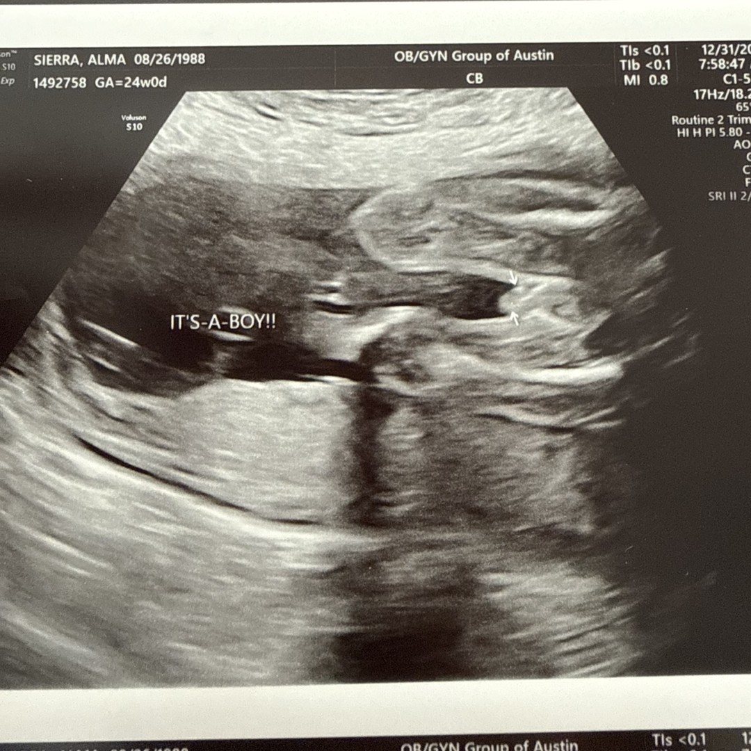 Photo shared by Alma for their Babylist baby registry.