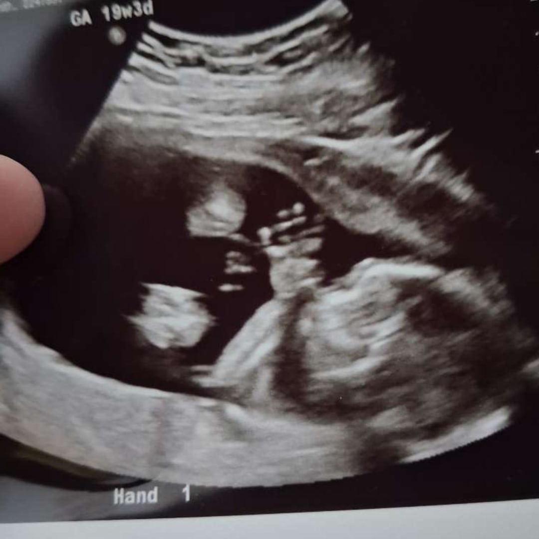 Photo shared by Sam for their Babylist baby registry.