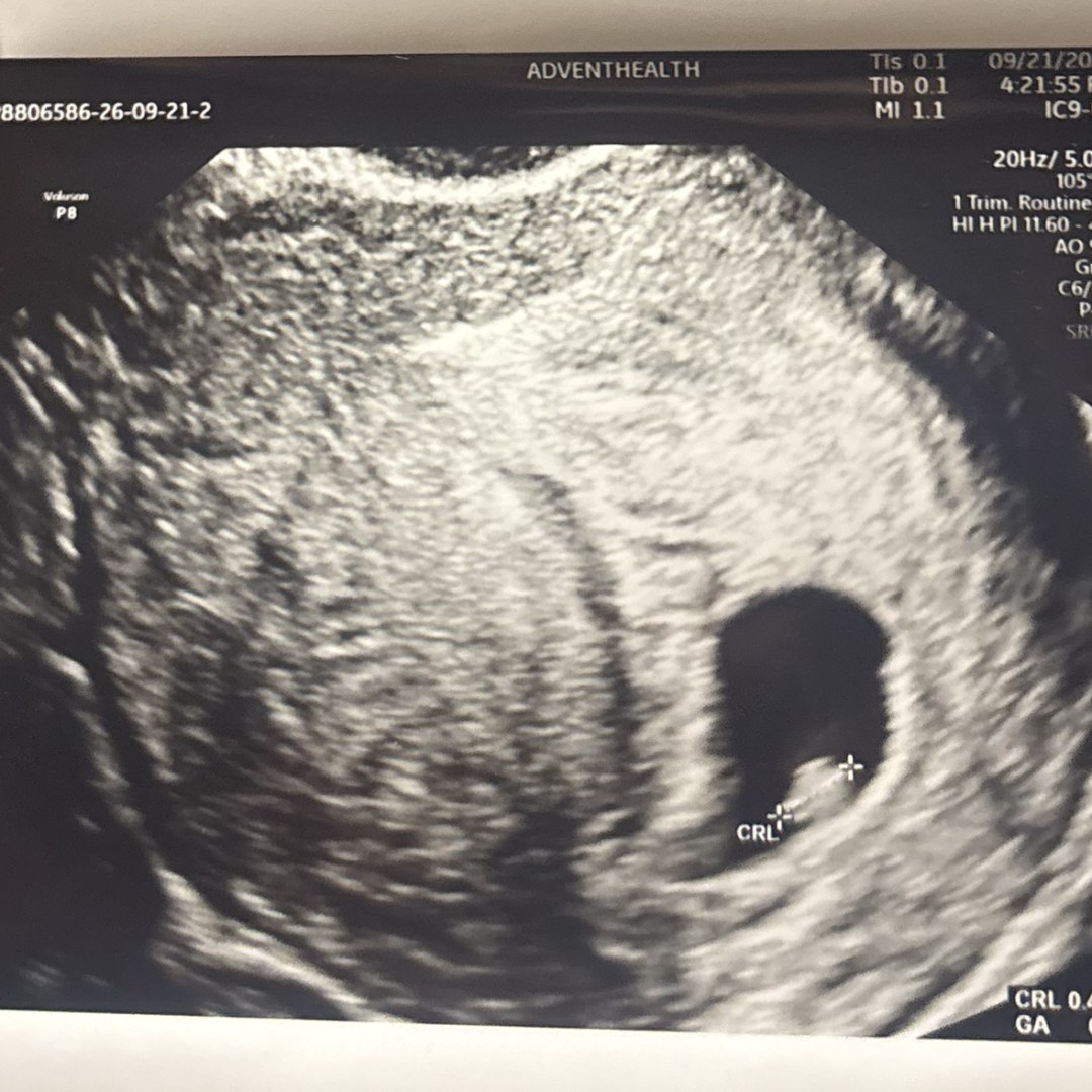 Photo shared by Emily for their Babylist baby registry.
