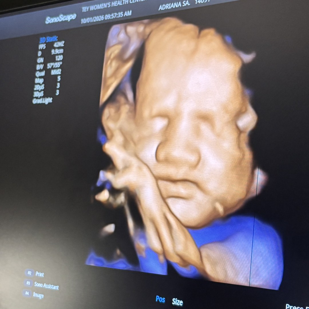 Photo shared by Karla for their Babylist baby registry.