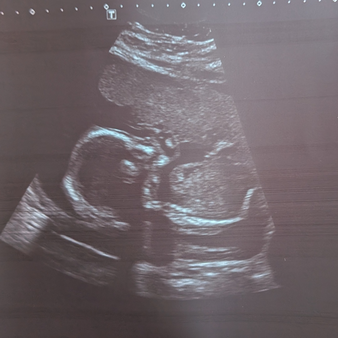 Photo shared by Alyssa for their Babylist baby registry.