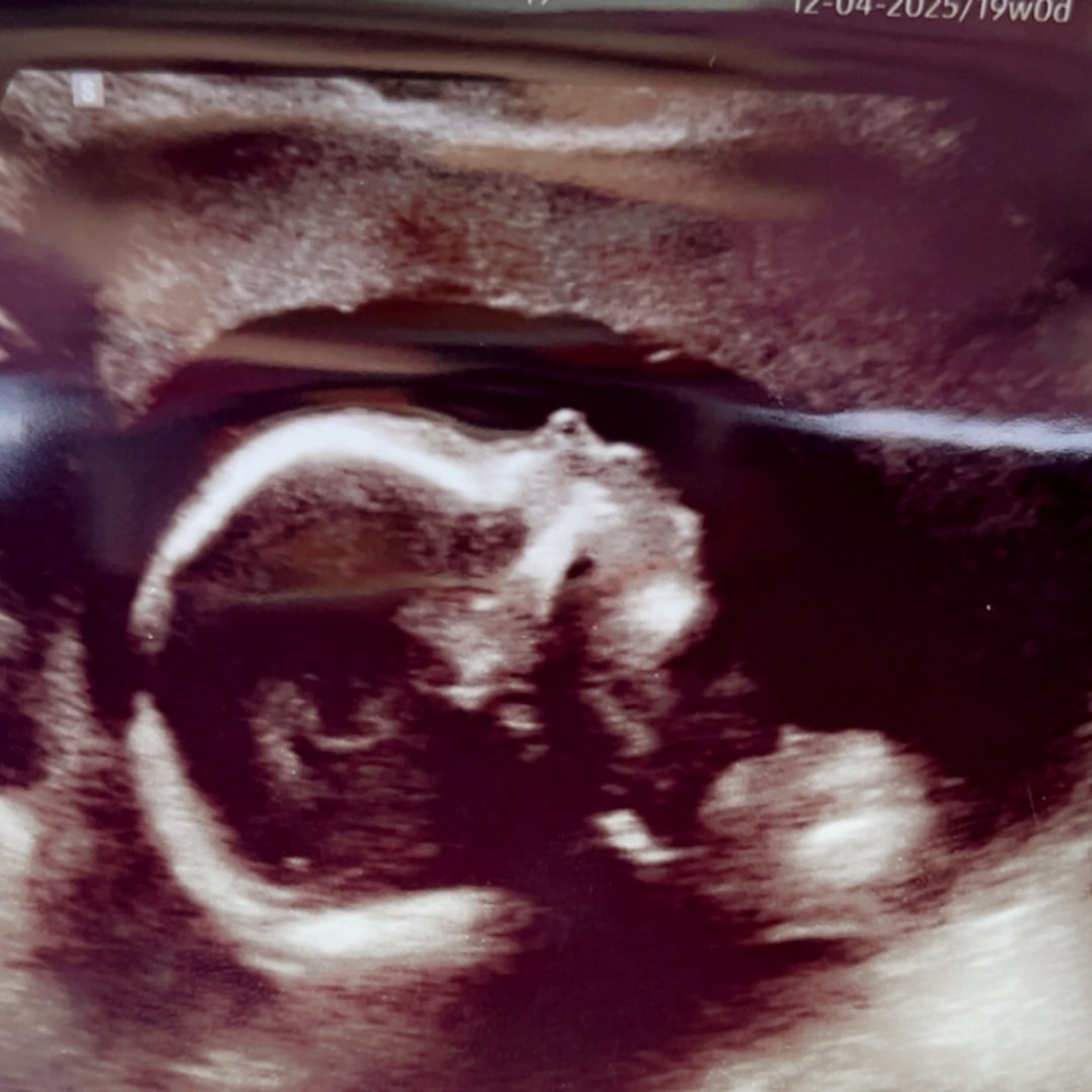 Photo shared by Karlee for their Babylist baby registry.