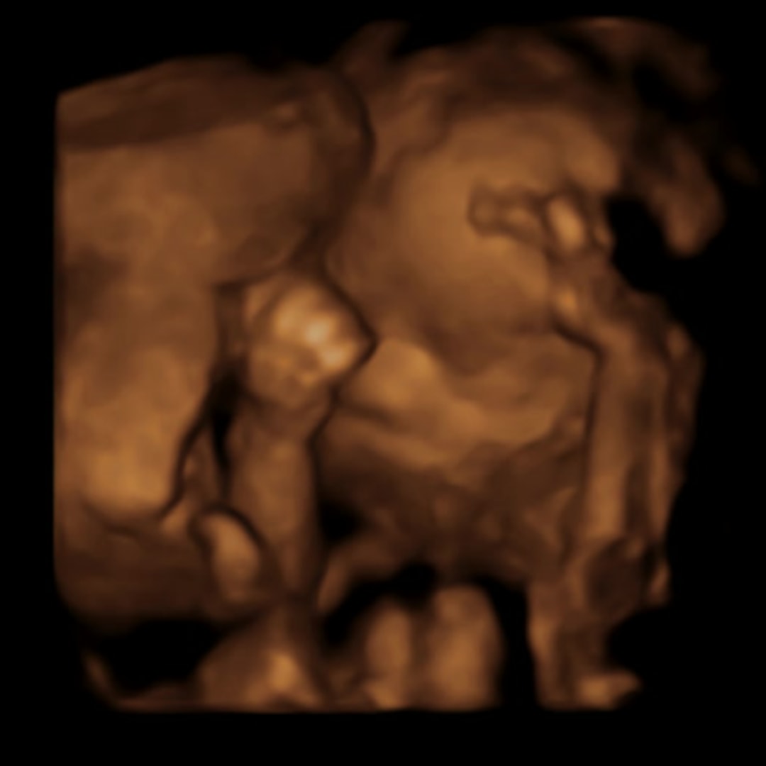 Photo shared by McKenzie for their Babylist baby registry.