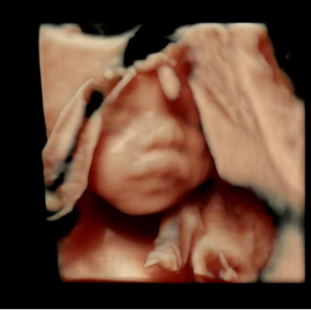 Photo shared by Chantel for their Babylist baby registry.