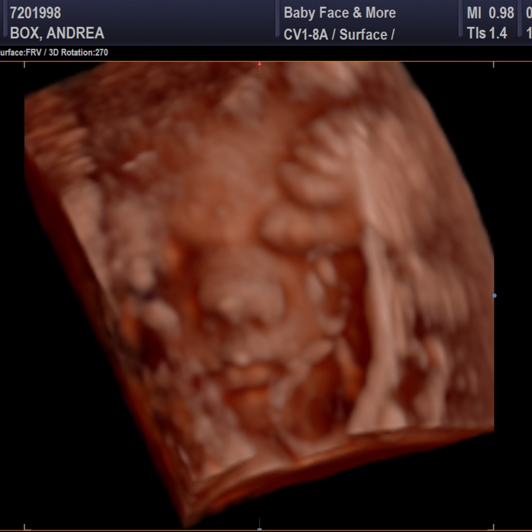Photo shared by Andrea for their Babylist baby registry.