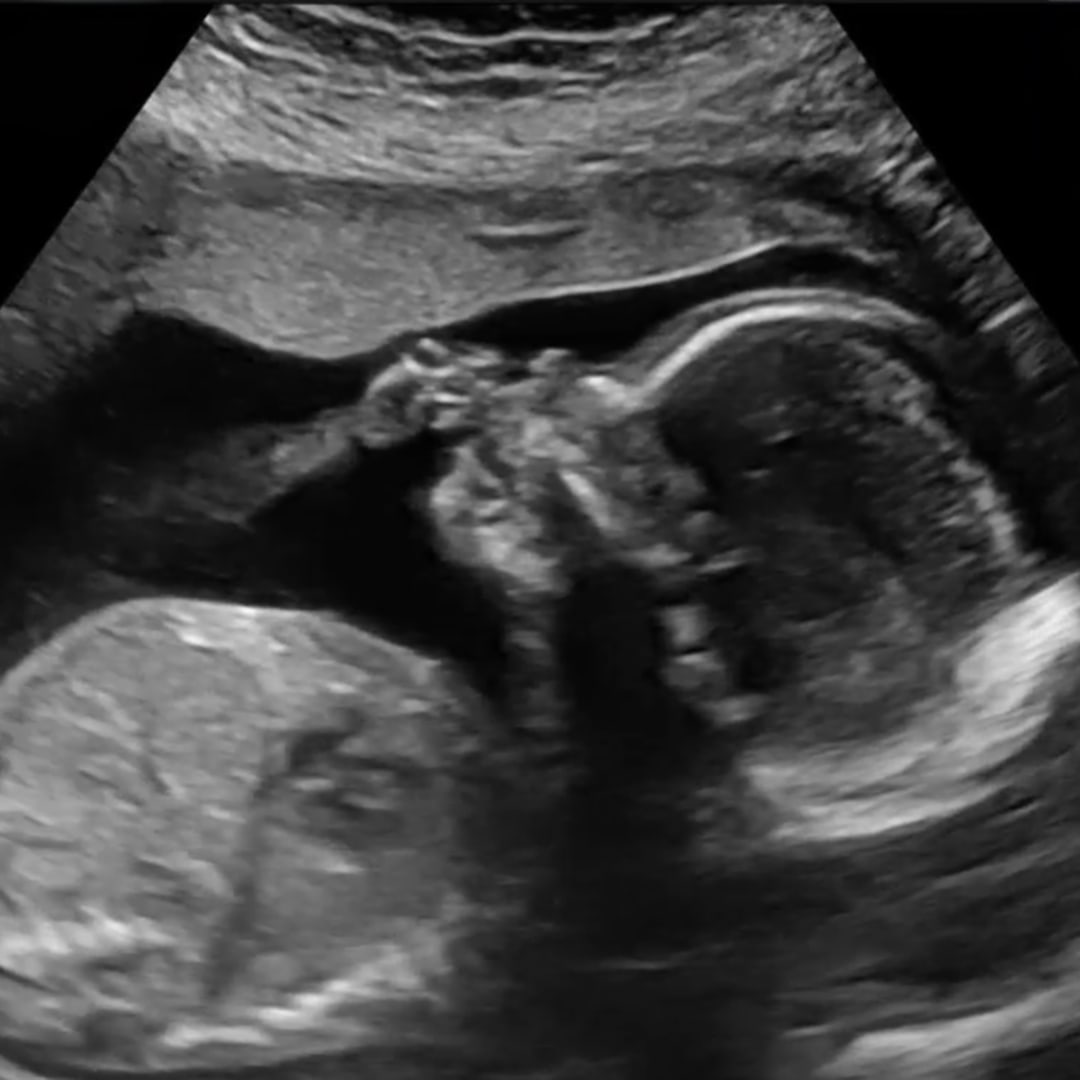 Photo shared by Savanna for their Babylist baby registry.