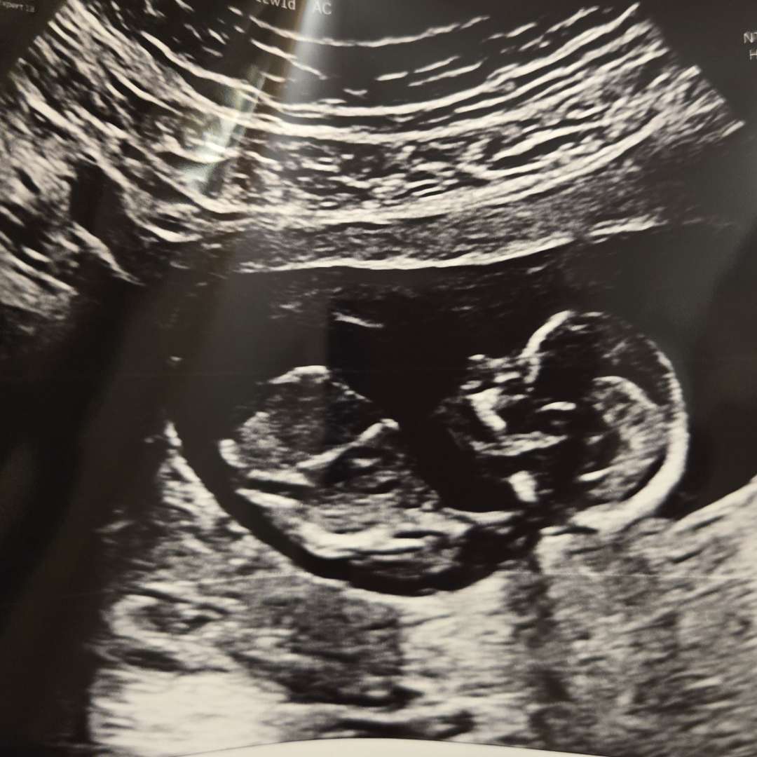 Photo shared by Ana for their Babylist baby registry.