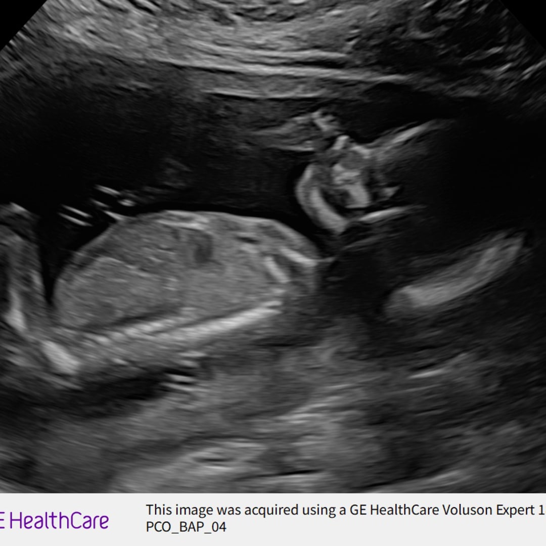 Photo shared by Kaylee for their Babylist baby registry.