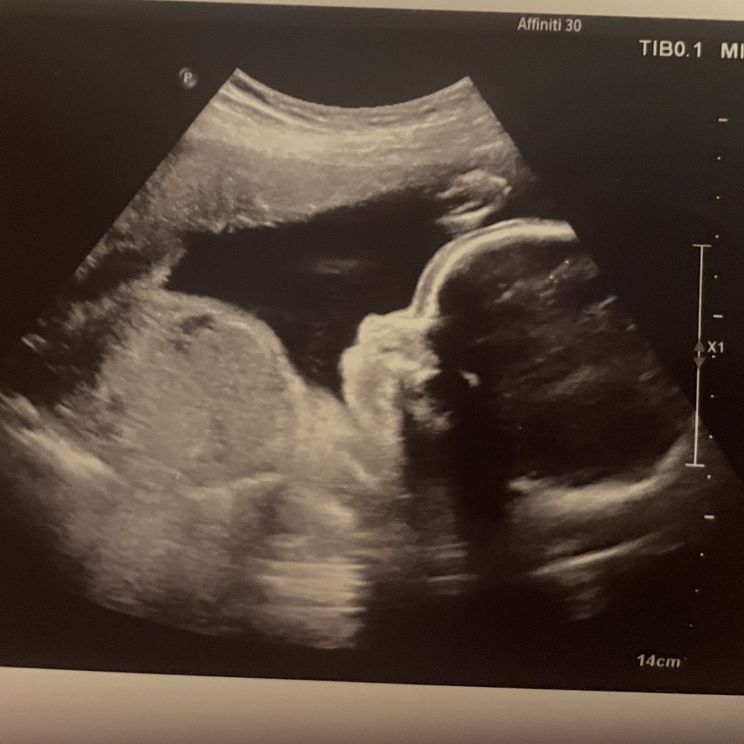 Photo shared by Joylin for their Babylist baby registry.
