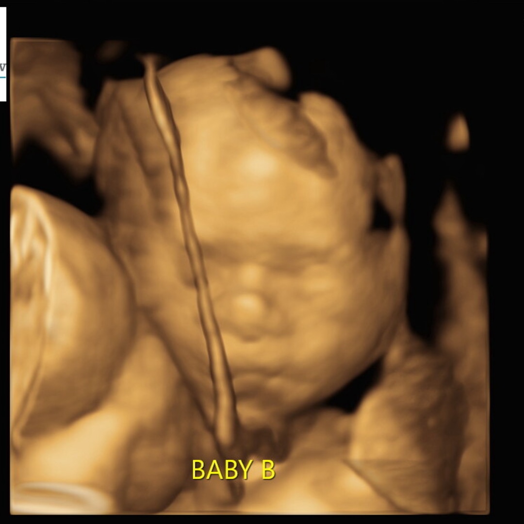 Photo shared by Brooke for their Babylist baby registry.